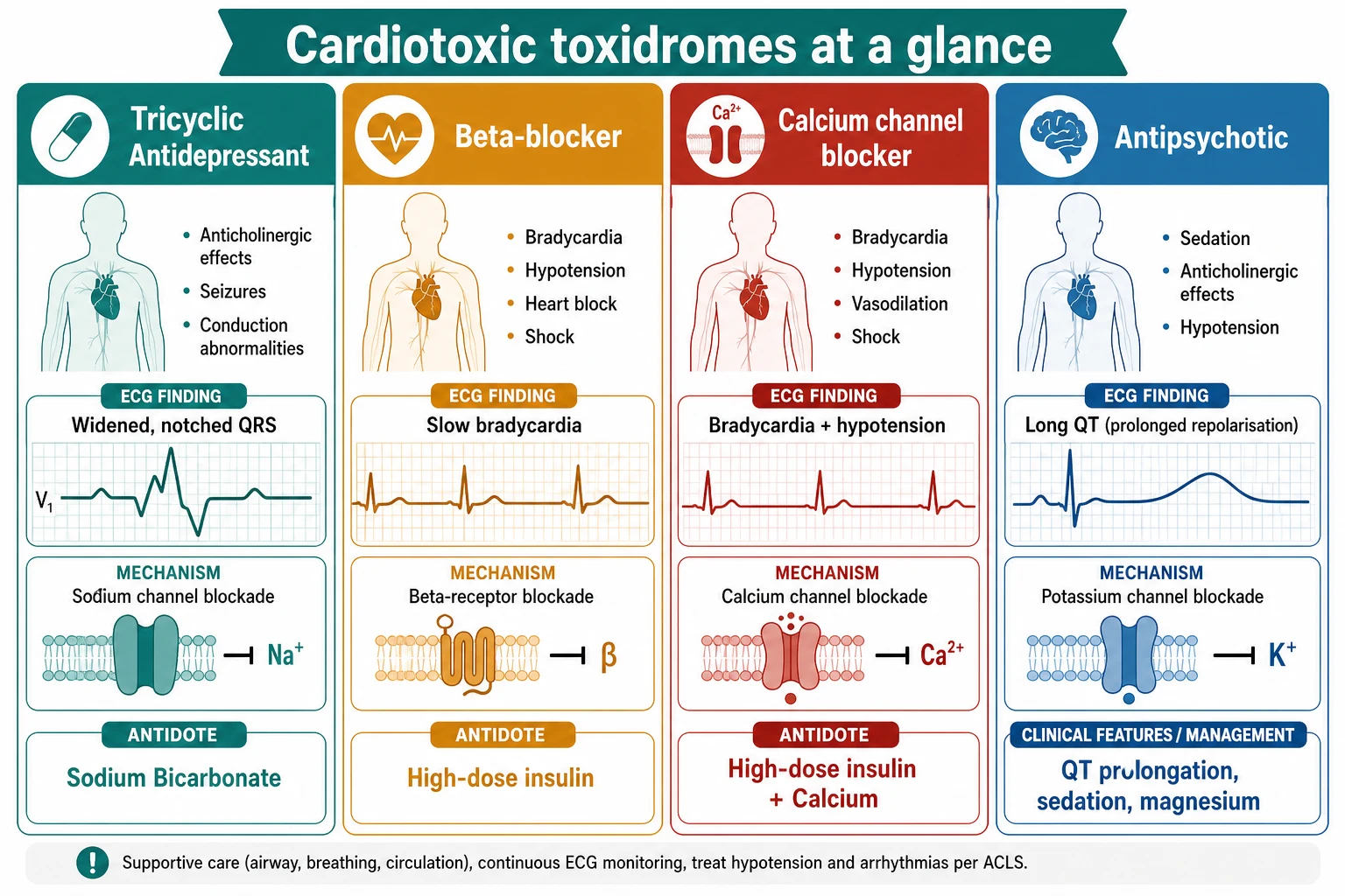 Reviewed educational schematic contrasting four cardiotoxic toxidromes in columns: tricyclic antidepressant with a widened notched QRS, sodium-channel blockade and sodium bicarbonate; beta-blocker with bradycardia, beta-receptor blockade and high-dose insulin; calcium channel blocker with bradycardia and hypotension, calcium-channel blockade and high-dose insulin plus calcium; and antipsychotic with a long QT, potassium-channel blockade and magnesium with supportive care