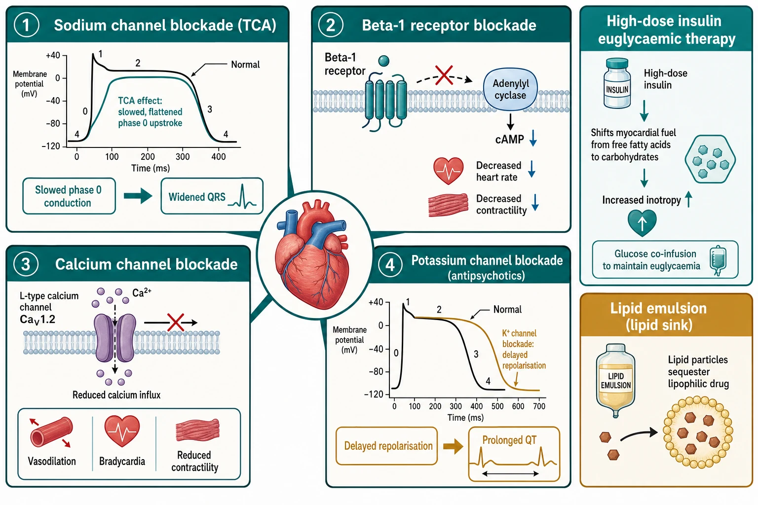 Reviewed educational schematic of four ion-channel and receptor mechanisms of cardiotoxic poisoning: sodium-channel blockade from a tricyclic slowing phase 0 and widening the QRS, beta-1 and L-type calcium-channel blockade reducing heart rate and contractility, potassium-channel blockade prolonging the QT, with the high-dose insulin metabolic-shift mechanism and the intravenous lipid emulsion lipid sink shown as adjuncts