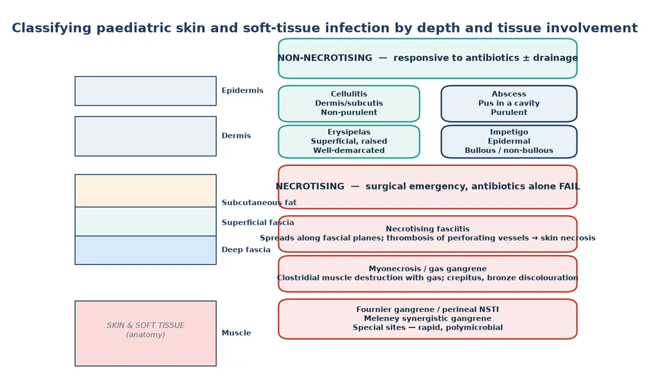 Classification of paediatric skin and soft-tissue infection by tissue depth and by non-purulent, purulent, and necrotising categories, showing cellulitis, erysipelas, abscess, impetigo, necrotising fasciitis, myonecrosis, and Fournier gangrene against the skin layer anatomy.
