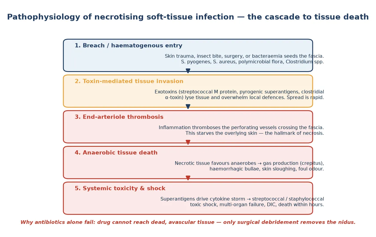 Pathophysiology cascade of necrotising soft-tissue infection from pathogen entry through toxin-mediated tissue invasion, end-arteriole thrombosis, anaerobic tissue death with gas, and systemic toxic shock.