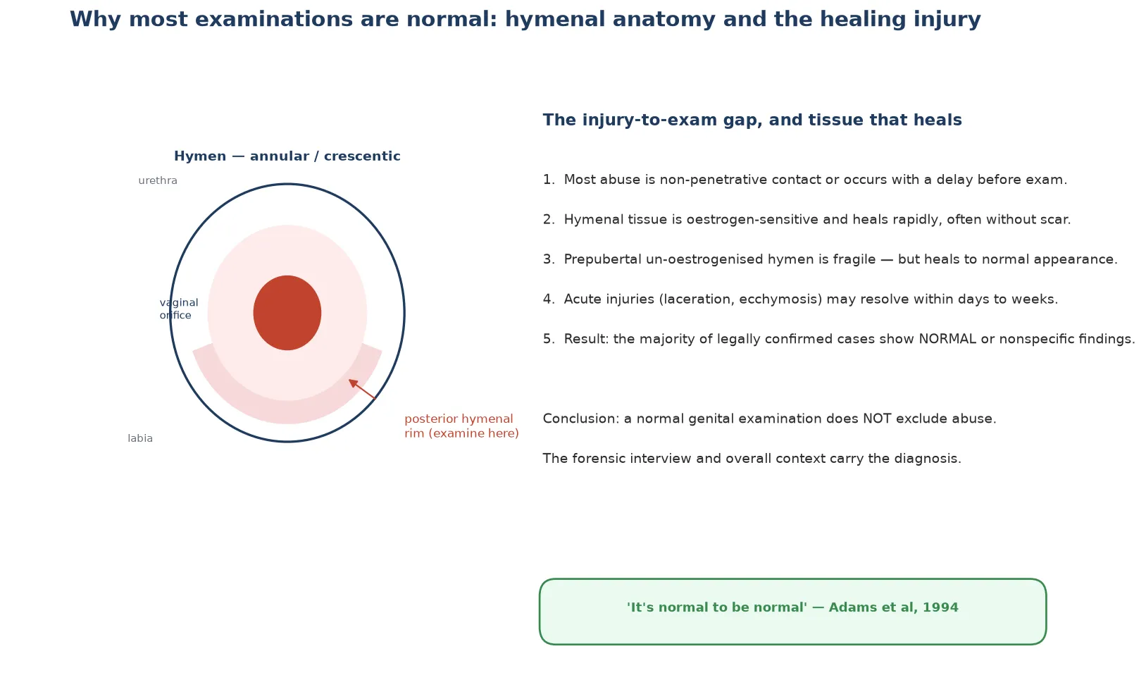 Educational schematic of hymenal anatomy with the posterior rim highlighted, and an explanation of rapid mucosal healing leading to normal examinations
