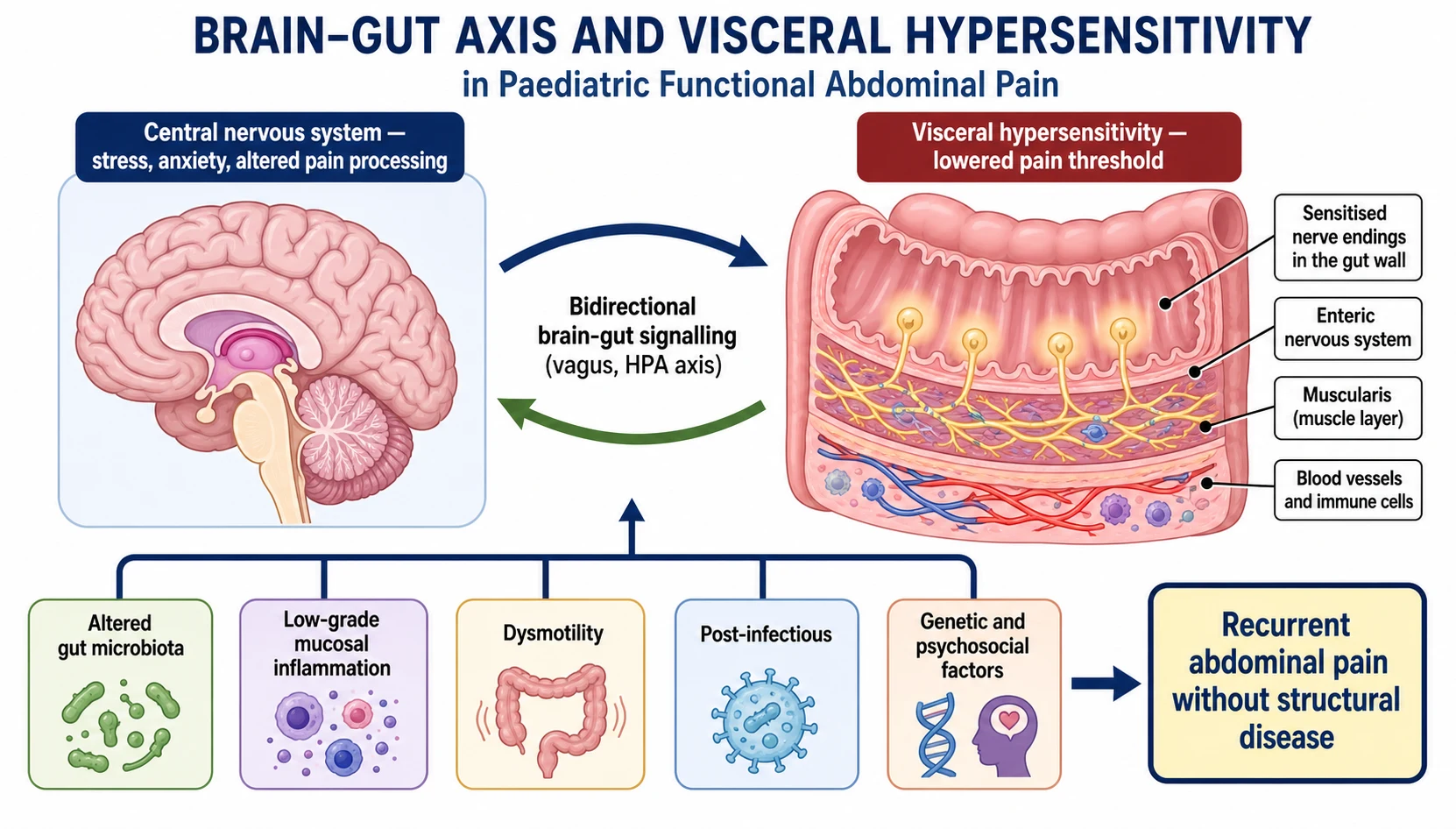 Pathophysiology diagram of the brain-gut axis showing the central nervous system connected by bidirectional signalling to the gut, with visceral hypersensitivity, altered microbiota, low-grade inflammation, dysmotility, and psychosocial factors converging on recurrent abdominal pain without structural disease.