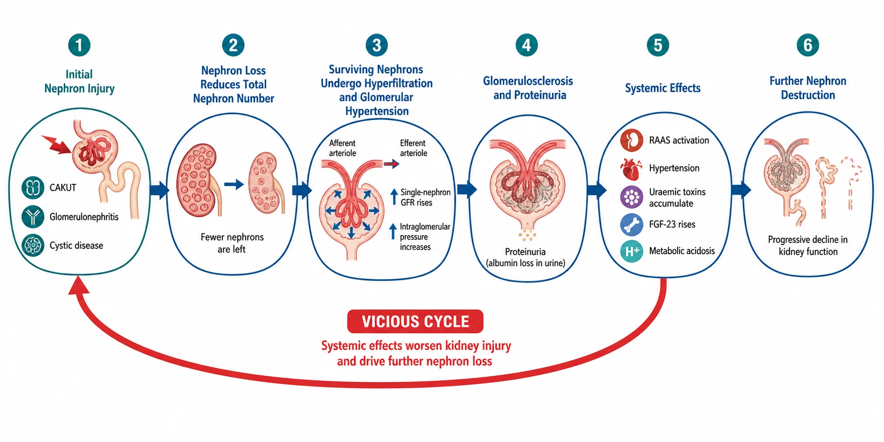 Pathophysiology cascade of chronic kidney disease progression: initial nephron injury from CAKUT, glomerulonephritis or cystic disease reduces nephron number; surviving nephrons undergo hyperfiltration and glomerular hypertension with rising single-nephron GFR; this causes glomerulosclerosis and proteinuria; systemic effects follow with RAAS activation, hypertension, uraemic toxins, rising FGF-23 and metabolic acidosis; a red vicious-cycle arrow shows systemic effects feeding back to worsen kidney injury and drive further nephron loss.