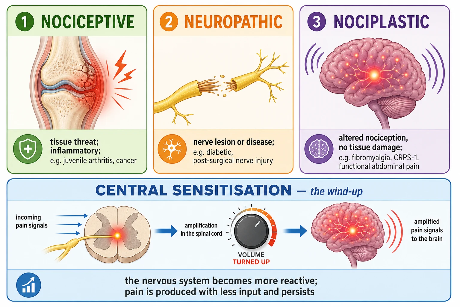 Three pain mechanisms (nociceptive, neuropathic, nociplastic) shown as cards above a banner depicting central sensitisation and an amplified nervous-system signal.