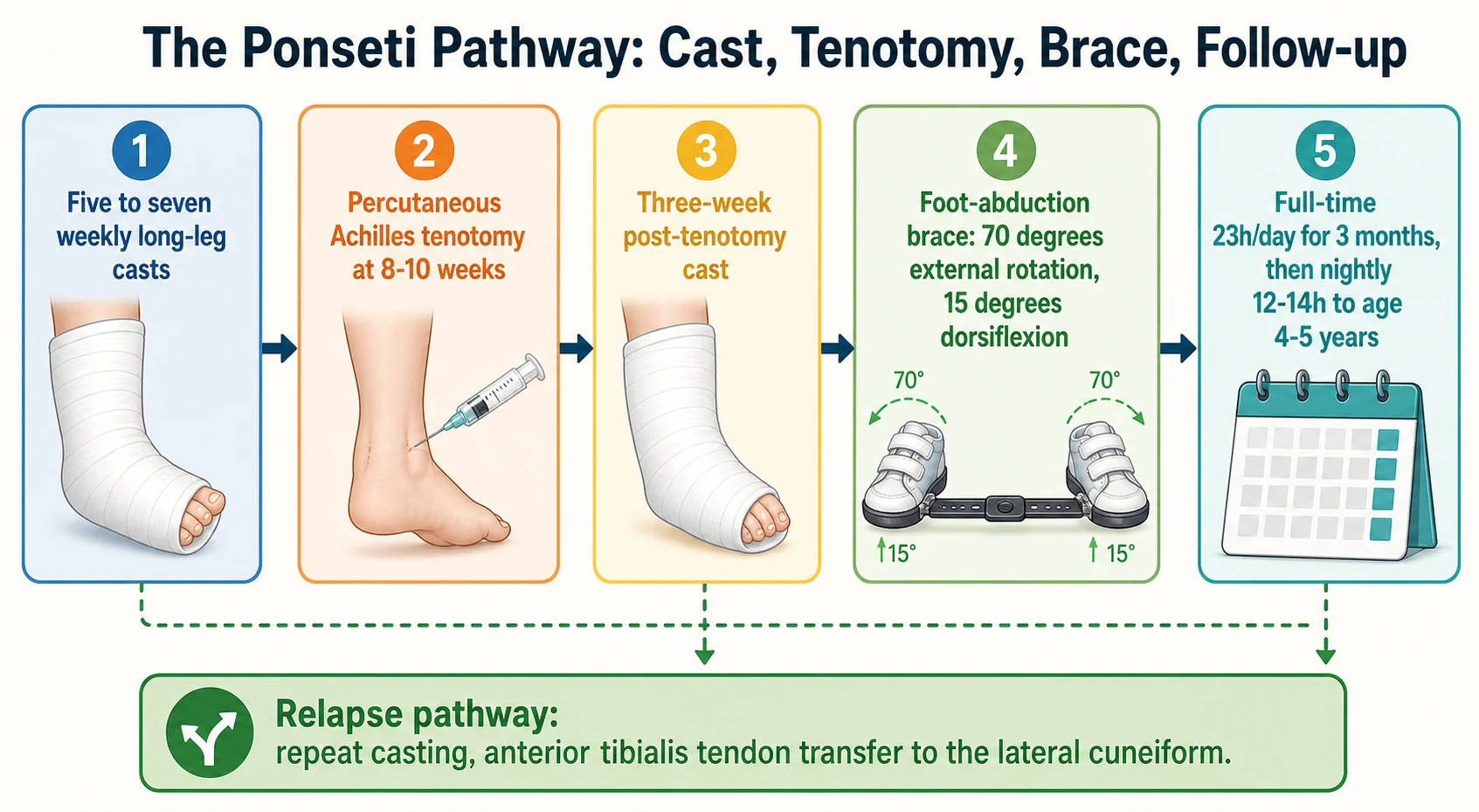 Horizontal stepwise pathway of the Ponseti method with five numbered boxes connected by arrows, ending in a green decision banner. Box one: five to seven weekly long-leg casts. Box two: percutaneous Achilles tenotomy at eight to ten weeks. Box three: three-week post-tenotomy cast. Box four: foot-abduction brace at seventy degrees external rotation and fifteen degrees dorsiflexion. Box five: full-time for three months, then nightly to four to five years. Below, a green decision banner: relapse pathway — repeat casting and anterior tibialis tendon transfer.
