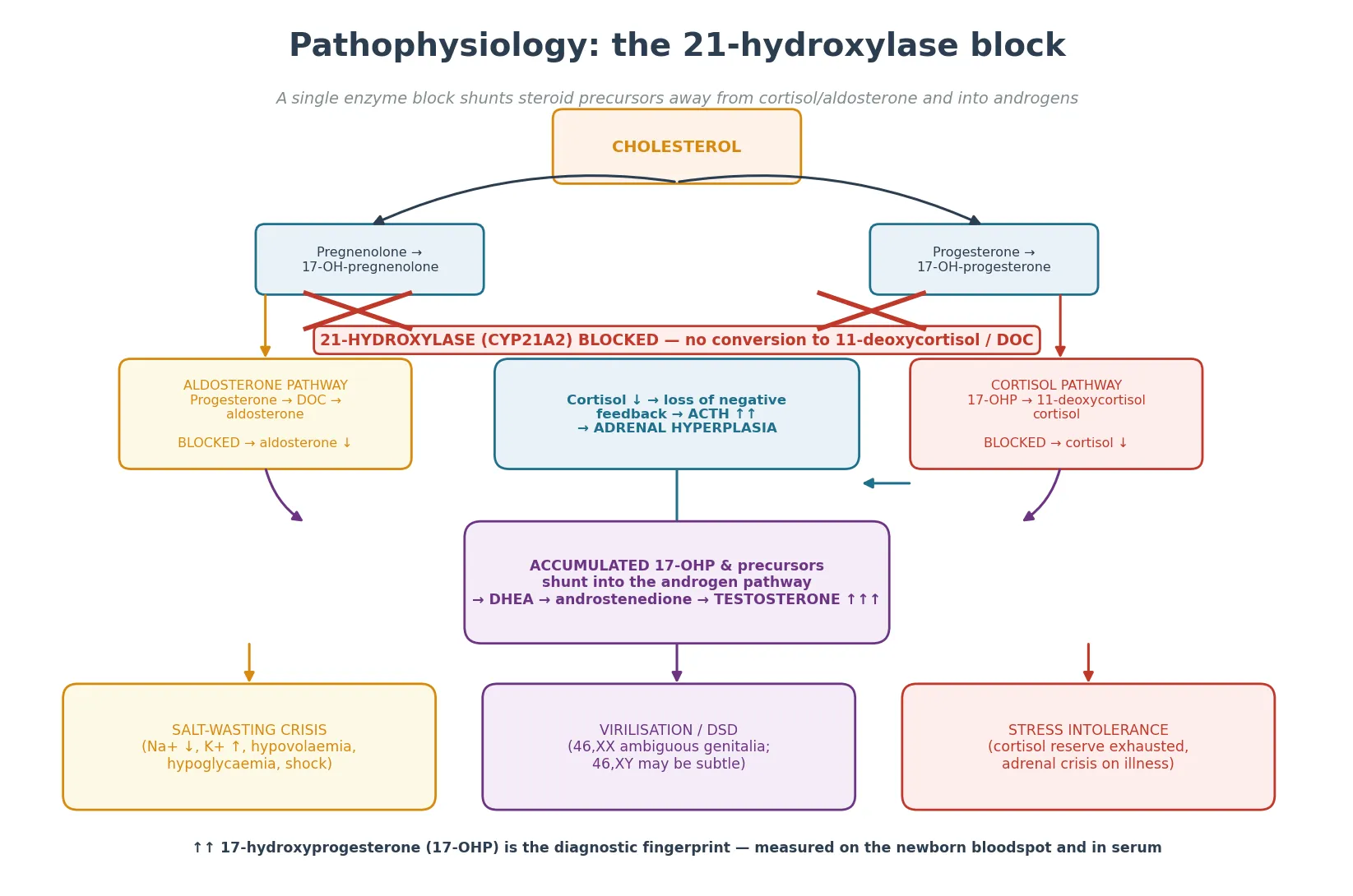 Steroidogenesis diagram with cholesterol branching into the cortisol and aldosterone pathways, both blocked at the 21-hydroxylase step, with accumulated precursors shunting into the androgen pathway, and the downstream clinical consequences of salt-wasting, virilisation and stress intolerance.