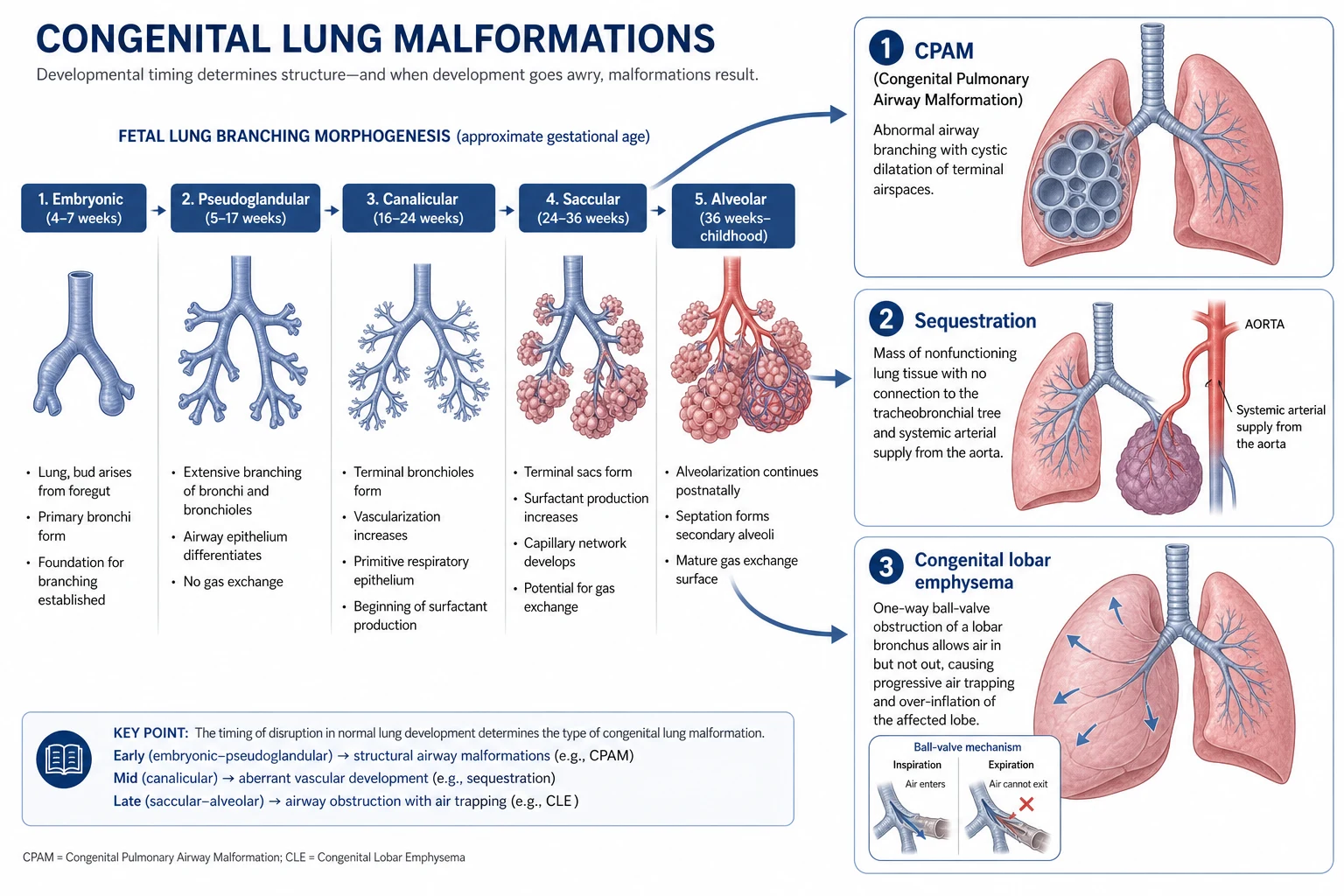Pathophysiology of congenital lung malformations showing branching morphogenesis and how developmental arrest produces CPAM, sequestration with systemic arterial supply, and congenital lobar emphysema from ball-valve air trapping