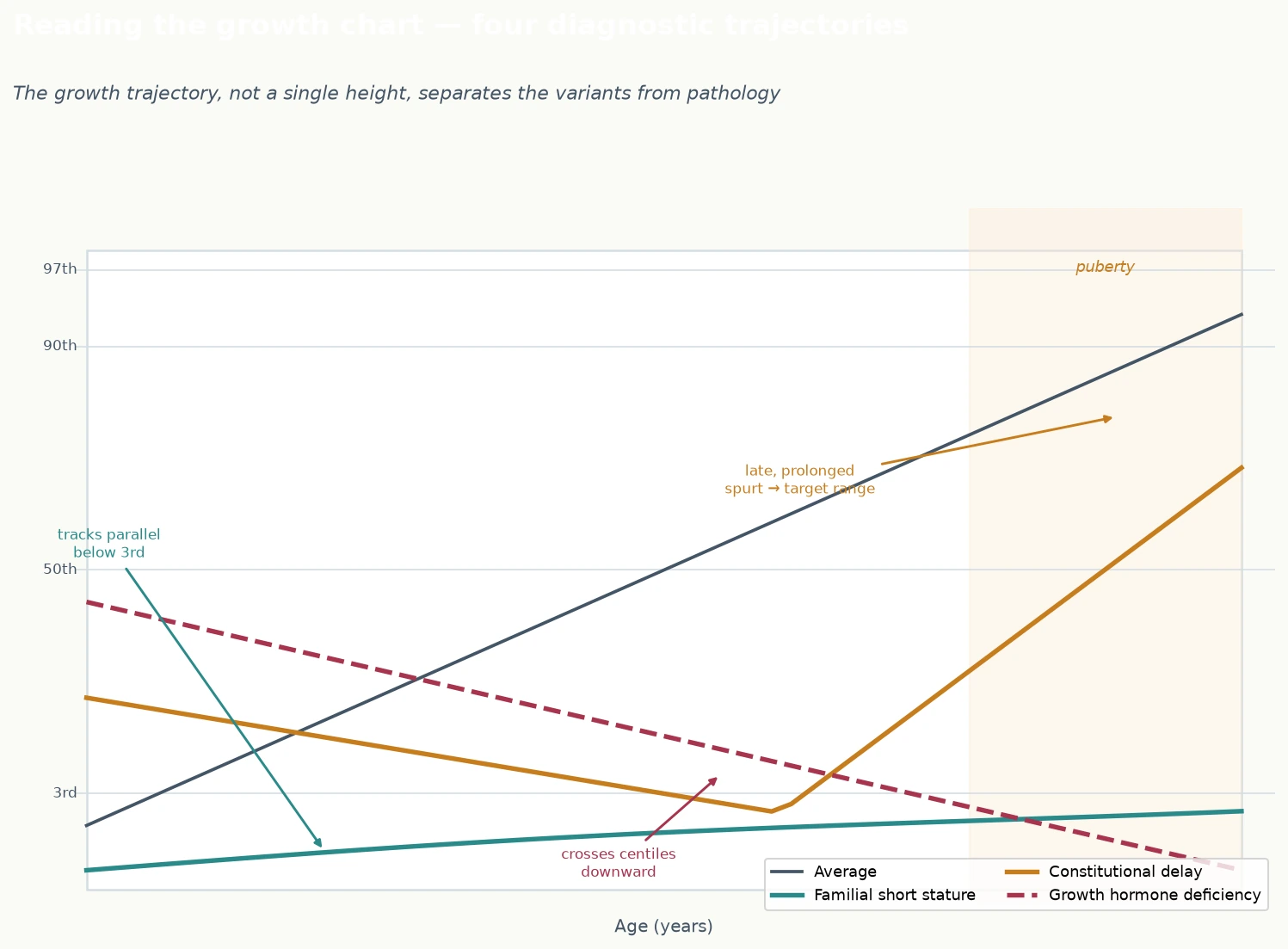 Four diagnostic growth-chart trajectories: familial short stature tracking parallel below the third centile, constitutional delay drifting down in childhood then a late prolonged pubertal spurt reaching the normal range, growth hormone deficiency crossing centiles downward with no catch-up, and the average child on the fiftieth centile