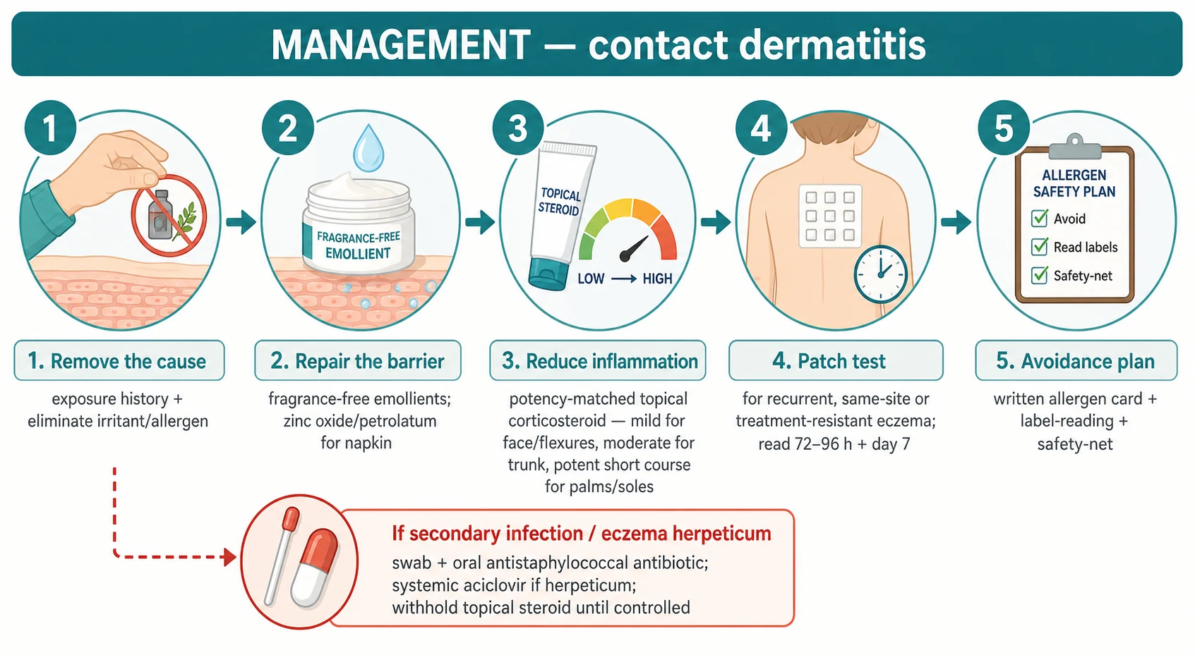 Educational schematic showing a stepwise management algorithm for contact dermatitis in children. Step one identify and remove the cause via exposure history; step two repair the barrier with fragrance-free emollients and barrier creams; step three suppress inflammation with a potency-matched topical corticosteroid (mild for face and flexures, moderate or potent for trunk and limbs); step four confirm allergy with patch testing in recurrent or treatment-resistant disease; step five long-term avoidance counselling and written allergen card; with a side branch for managing secondary infection and eczema herpeticum