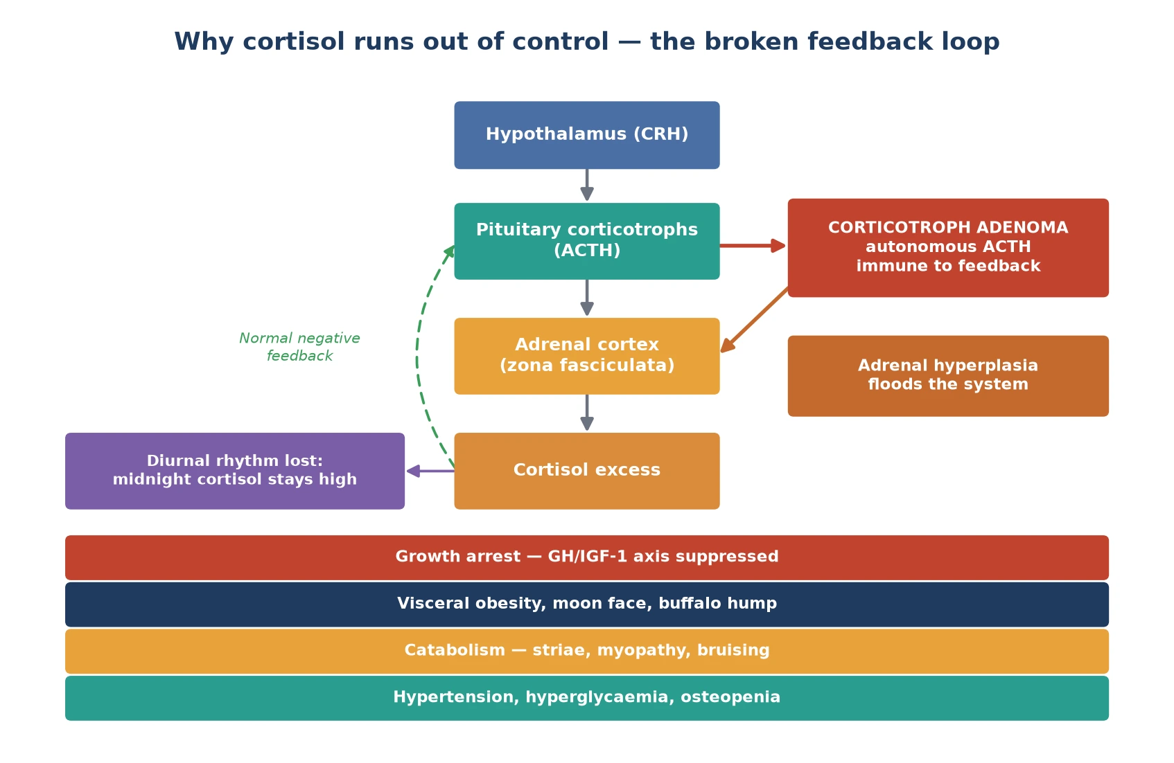 The hypothalamic-pituitary-adrenal axis with a corticotroph adenoma that secretes autonomous ACTH, immune to normal negative feedback, driving bilateral adrenal hyperplasia and cortisol excess. The loss of diurnal rhythm keeps midnight cortisol high, and downstream end-organ effects are growth arrest, visceral fat redistribution, catabolism with striae and myopathy, and hypertension with hyperglycaemia.
