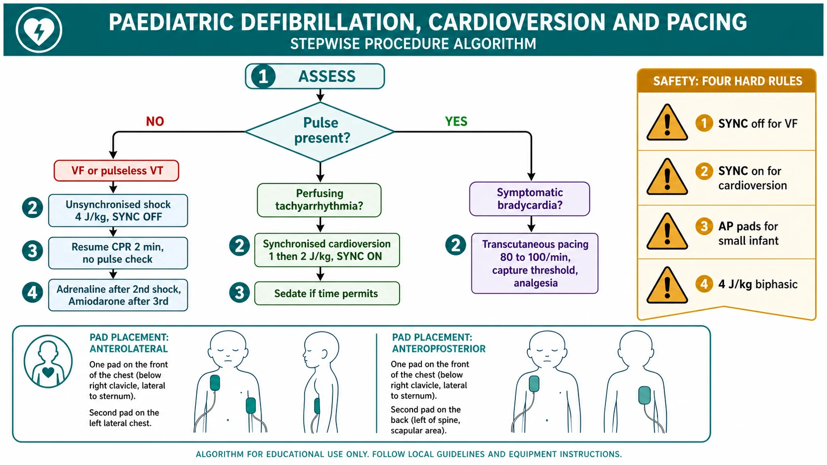 Educational stepwise algorithm for paediatric defibrillation cardioversion and transcutaneous pacing: assess rhythm and pulse, select mode and energy, place pads anterolateral or anteroposterior, deliver shock, resume CPR or assess capture, with a safety ribbon on sync mode weight-based doses and pad placement