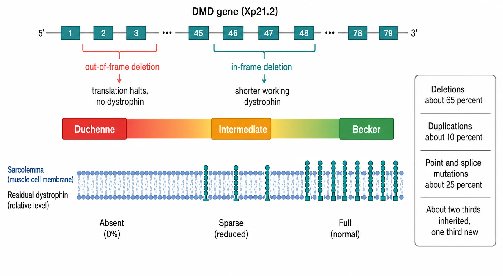 A clean medical-education schematic on a white background. A horizontal severity bar runs from a red Duchenne box on the left through an amber Intermediate box in the middle to a green Becker box on the right. Above the bar a gene diagram shows the DMD gene with a deletion; a coral out-of-frame deletion bracket points down to the Duchenne box and reads translation halts no dystrophin, while a teal in-frame deletion bracket points down to the Becker box and reads shorter working dystrophin. Below the bar a thin blue membrane strip shows the residual dystrophin level, full and green under Becker, absent under Duchenne. A side panel lists the mutation mix as deletions about 65 percent, duplications about 10 percent, and point mutations about 25 percent, and notes that about two thirds are inherited and one third are new.