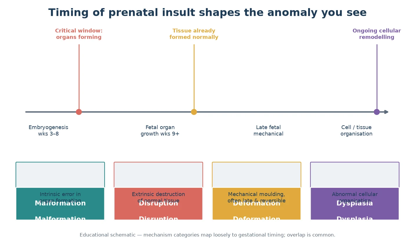 Timeline showing how the gestational timing of a prenatal insult maps to the anomaly type observed: embryogenesis to malformation, mechanical forces to deformation, destruction to disruption, cellular disorganisation to dysplasia