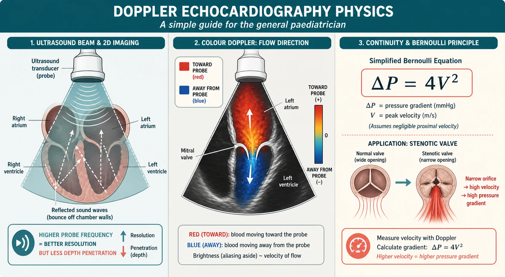 Educational schematic of Doppler echocardiography physics: an ultrasound transducer sending a fan-shaped beam into a simplified heart chamber, a colour Doppler panel showing red flow toward the probe and blue flow away, and the simplified Bernoulli equation stating pressure gradient equals four times velocity squared applied to a stenotic valve with a high-velocity jet
