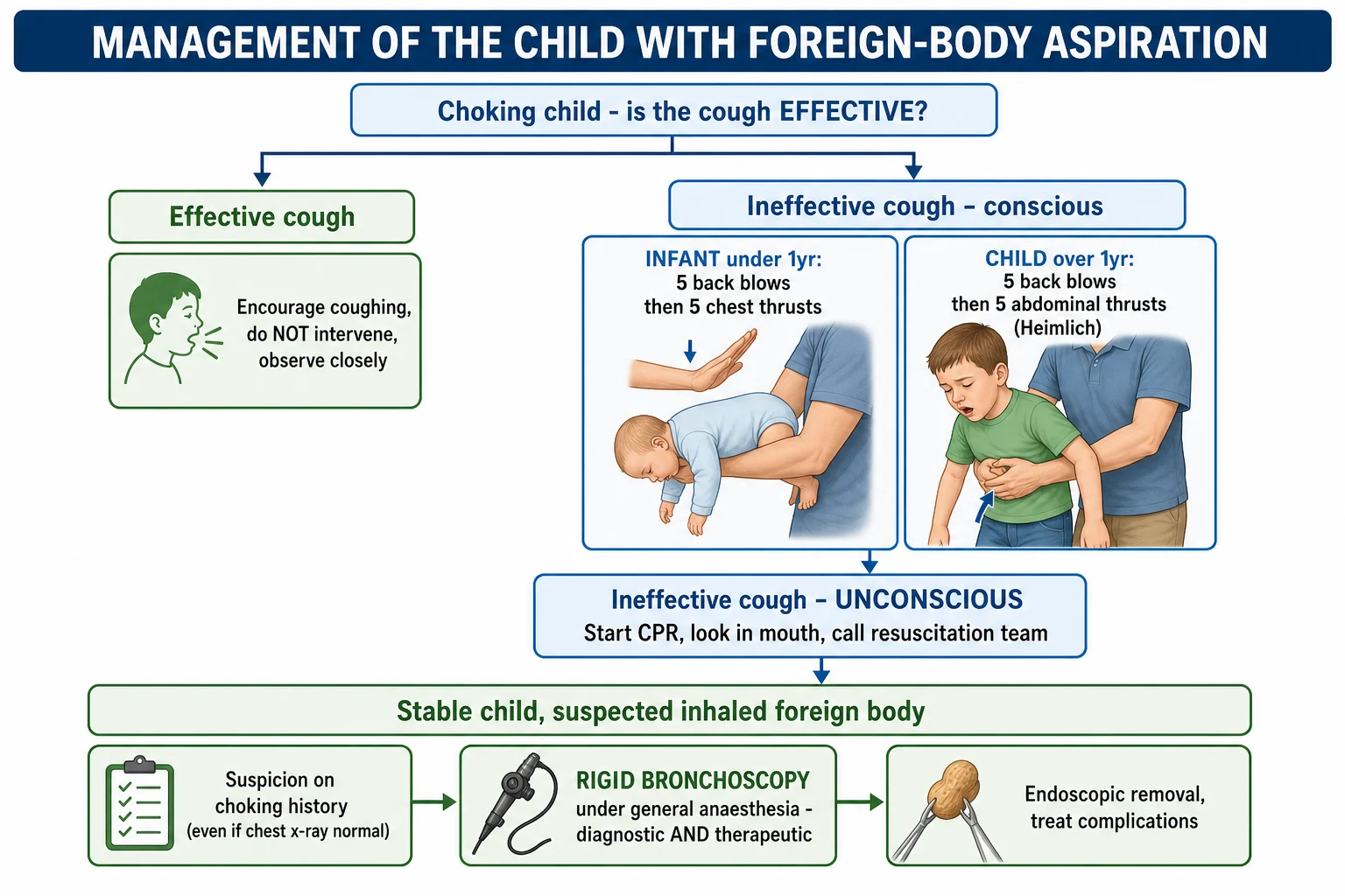 Management algorithm for the child with foreign-body aspiration showing the choking algorithm that begins by asking whether the cough is effective, with encouragement to keep coughing if effective, and for an ineffective cough in a conscious child five back blows then five chest thrusts in an infant under one year or five back blows then five abdominal thrusts in a child over one year, progressing to CPR and calling for help if the child becomes unconscious, and the separate stable-child pathway where suspicion on the choking history even with a normal chest radiograph leads to rigid bronchoscopy under general anaesthesia for diagnosis and removal and treatment of complications