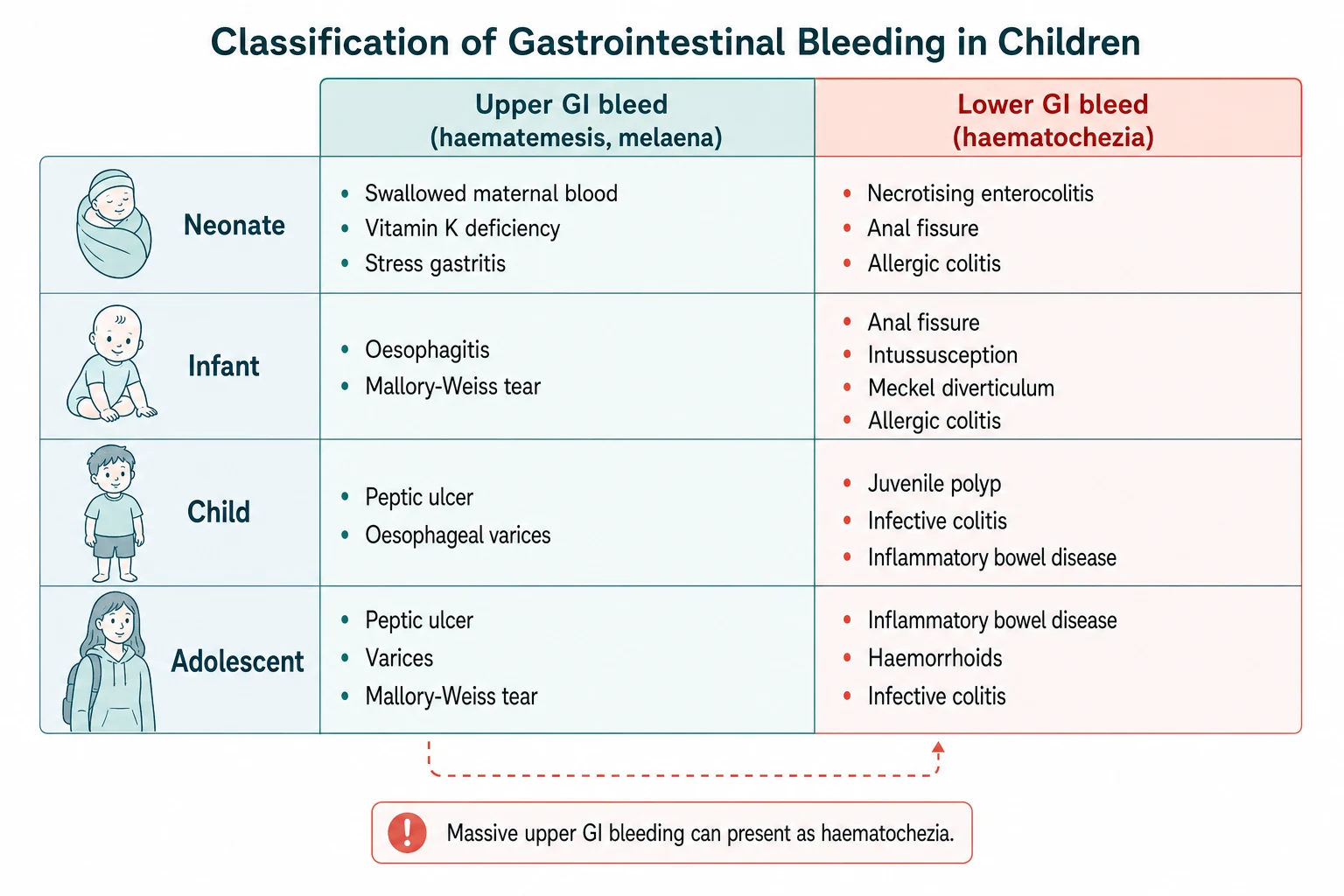 Two-axis classification grid of gastrointestinal bleeding in children. The vertical axis lists the age bands neonate, infant, child and adolescent. The horizontal axis splits upper gastrointestinal bleed with haematemesis and melaena from lower gastrointestinal bleed with haematochezia. Each cell lists typical causes such as swallowed maternal blood and necrotising enterocolitis in the neonate, intussusception and Meckel diverticulum in the infant, juvenile polyp and varices in the child, and inflammatory bowel disease in the adolescent.