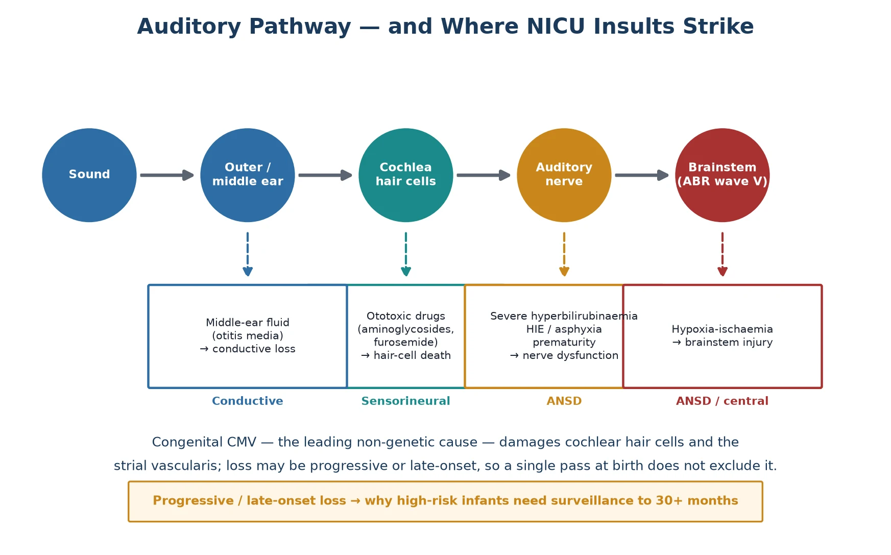 Auditory pathway from sound through outer and middle ear, cochlear hair cells, auditory nerve and brainstem, with NICU insults mapped to each site