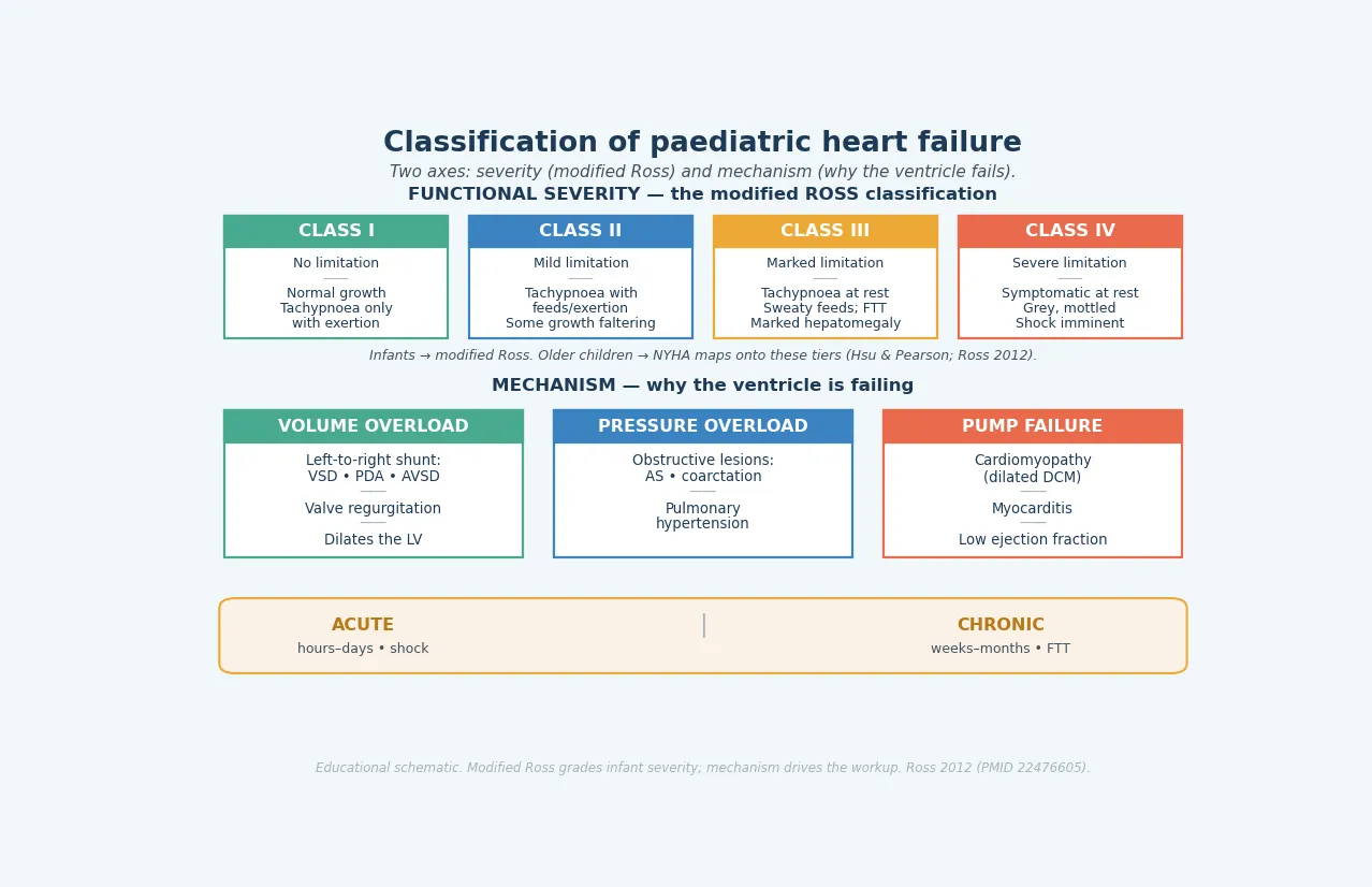 Classification of paediatric heart failure on two axes: the modified Ross severity grades I to IV, and the three failure mechanisms (volume overload, pressure overload, pump failure), with the acute-versus-chronic time course