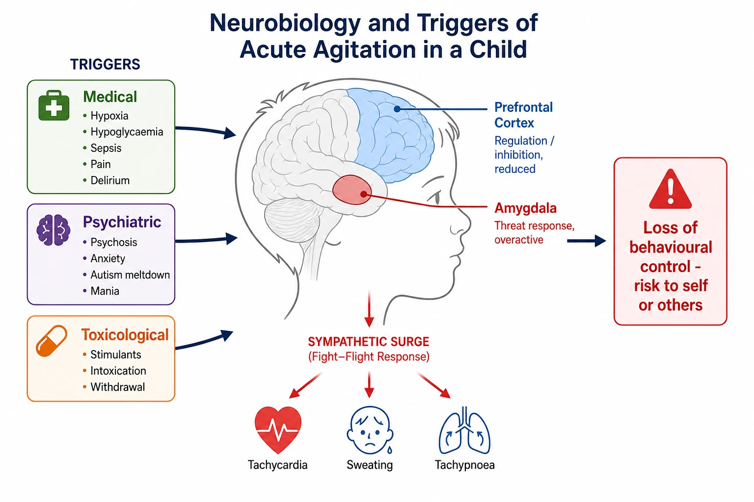 Neurobiology and triggers of acute agitation in a child. Prefrontal cortex (regulation and inhibition, reduced) and amygdala (threat response, overactive) shown in a head profile, fed by medical, psychiatric and toxicological trigger boxes, with sympathetic surge to tachycardia, sweating and tachypnoea, producing loss of behavioural control with risk to self or others.