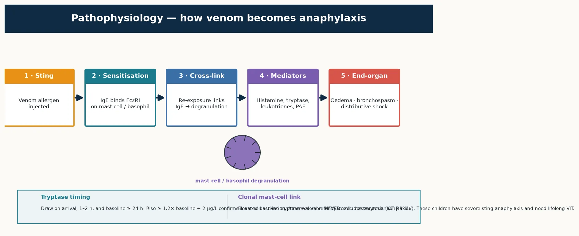 Left-to-right pathophysiology cascade for venom allergy: stage 1 the sting injecting venom allergen, stage 2 IgE binding the Fc-epsilon-RI receptor on mast cells and basophils, stage 3 re-exposure cross-linking IgE and triggering degranulation, stage 4 release of histamine, tryptase, leukotrienes and platelet-activating factor, and stage 5 the end-organ effects of oedema, bronchospasm and distributive shock, with footnotes on tryptase timing and the clonal mast-cell link