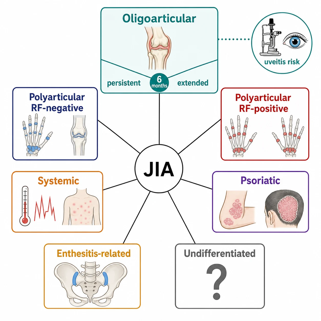 A clean schematic on a white background showing the ILAR classification of juvenile idiopathic arthritis branching from a central point into seven labelled boxes arranged in a ring. The oligoarticular box is largest and highlighted in teal, split into a persistent and an extended arm at the six-month mark. The polyarticular rheumatoid-factor negative box and the systemic box are shown alongside the smaller polyarticular rheumatoid-factor positive, psoriatic, enthesitis-related and undifferentiated boxes. Each box carries a small icon: a single swollen knee for oligoarticular, multiple joints for polyarticular, a fever spike and salmon-pink rash for systemic, skin plaques for psoriatic, a sacroiliac joint for enthesitis-related, and a question mark for undifferentiated. A slit-lamp icon links oligoarticular to a chronic anterior uveitis eye at high risk.