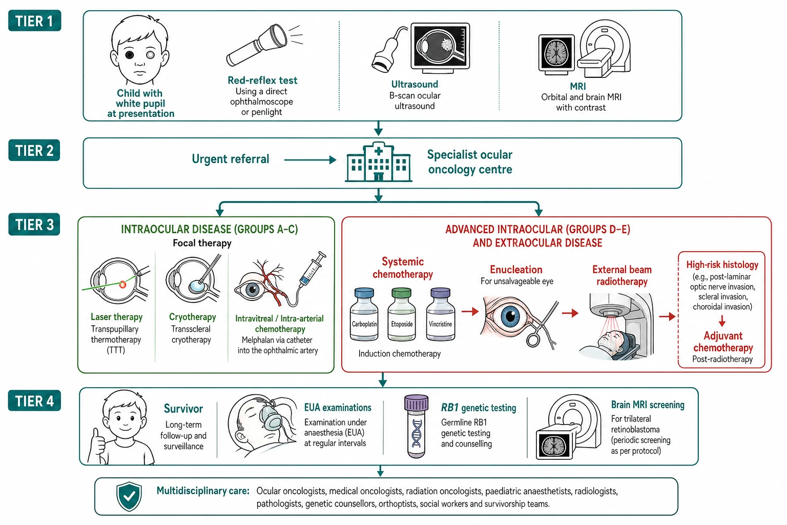 A clean medical flowchart on a white background in landscape flowing top to bottom in four tiers connected by teal arrows. The top tier shows a child with a white pupil at presentation, with icons for the red-reflex flashlight, the ultrasound and the MRI. The second tier is an urgent referral arrow to the specialist ocular oncology centre. The third tier splits into two parallel paths. The left path in green for the intraocular disease of groups A through C shows the focal therapy icons of laser, cryotherapy and the intra-arterial chemotherapy of melphalan via a catheter into the ophthalmic artery. The right path in amber-red for the advanced intraocular disease of groups D and E and the extraocular disease shows the systemic chemotherapy vials of carboplatin, etoposide and vincristine, then the enucleation icon for the unsalvageable eye, then the external beam radiotherapy, then the adjuvant chemotherapy for the high-risk histology. The bottom tier shows the survivor child with the follow-up icons of the examination under anaesthesia, the RB1 genetic testing vial and the brain MRI screening for the trilateral retinoblastoma