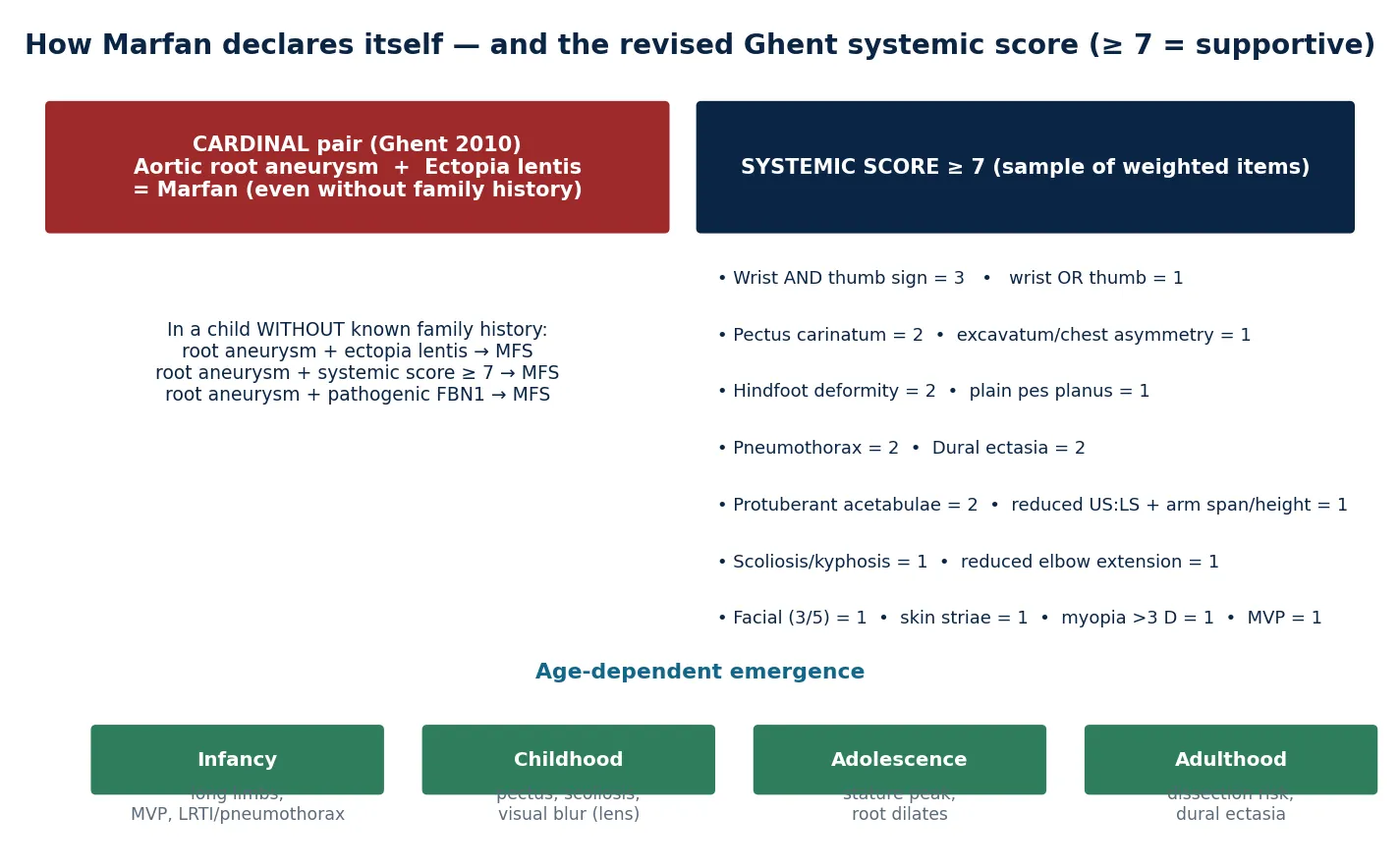 The revised Ghent cardinal pair of aortic-root aneurysm and ectopia lentis on the left, a sample of the weighted systemic-score items on the right with the threshold of seven or more, the diagnostic logic for a child without a family history, and an age-dependent timeline from infancy through adulthood showing how the phenotype emerges