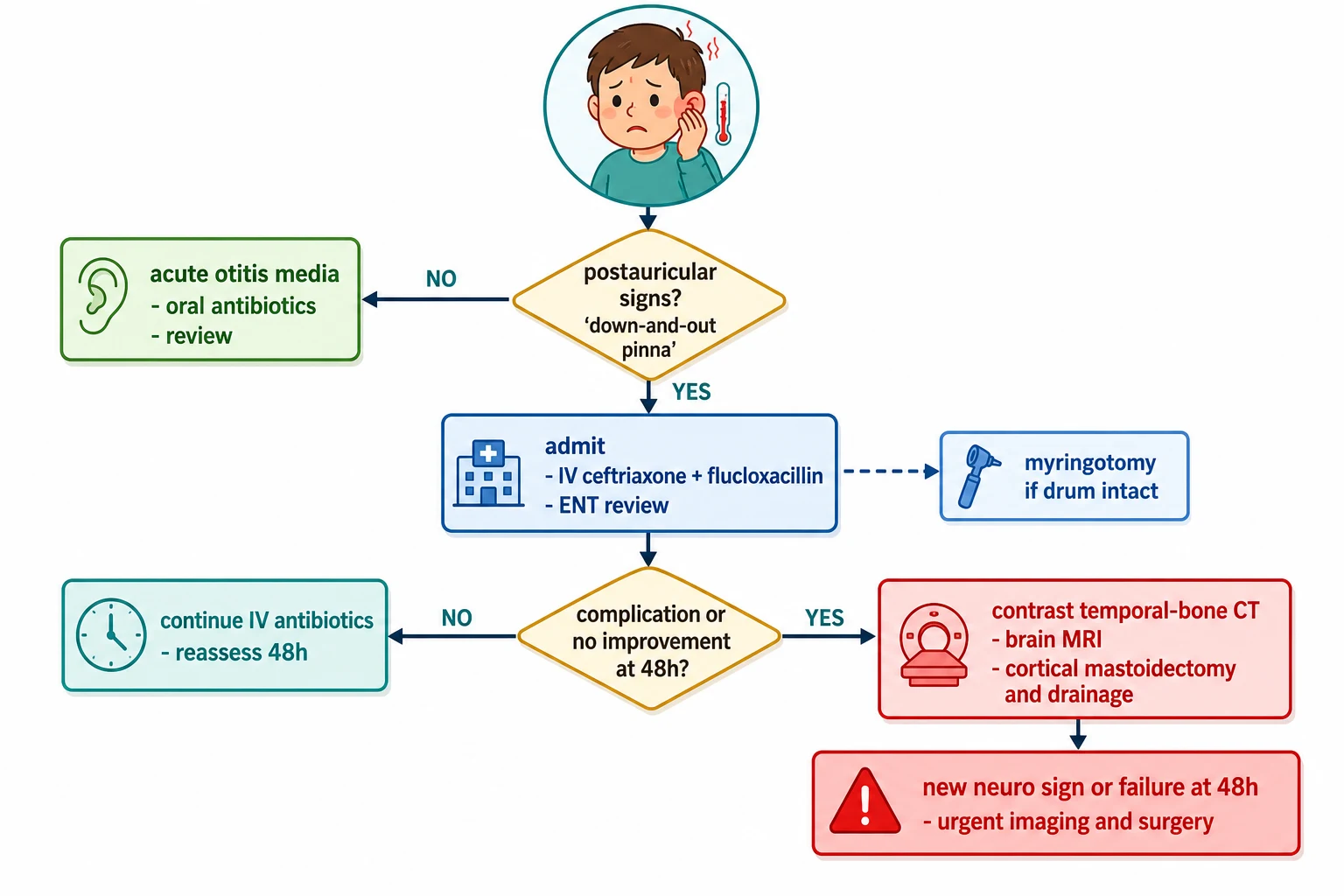 Stepwise clinical decision pathway for a febrile child with ear symptoms: a first decision diamond asks whether the postauricular signs are present with a down-and-out pinna; if no, manage as acute otitis media with oral antibiotics and review, and if yes, admit and start intravenous ceftriaxone plus flucloxacillin and urgent ENT review; a second decision diamond asks whether a complication is present — subperiosteal or Bezold abscess, lateral sinus thrombosis, Gradenigo syndrome, facial palsy or intracranial collection; if no, continue intravenous antibiotics with myringotomy for the intact drum and reassess at 48 hours; if yes, obtain contrast temporal-bone CT plus brain MRI with venography and proceed to cortical mastoidectomy and drainage, with a red warning box on no improvement or any neurological sign at 48 hours triggering urgent imaging and surgery