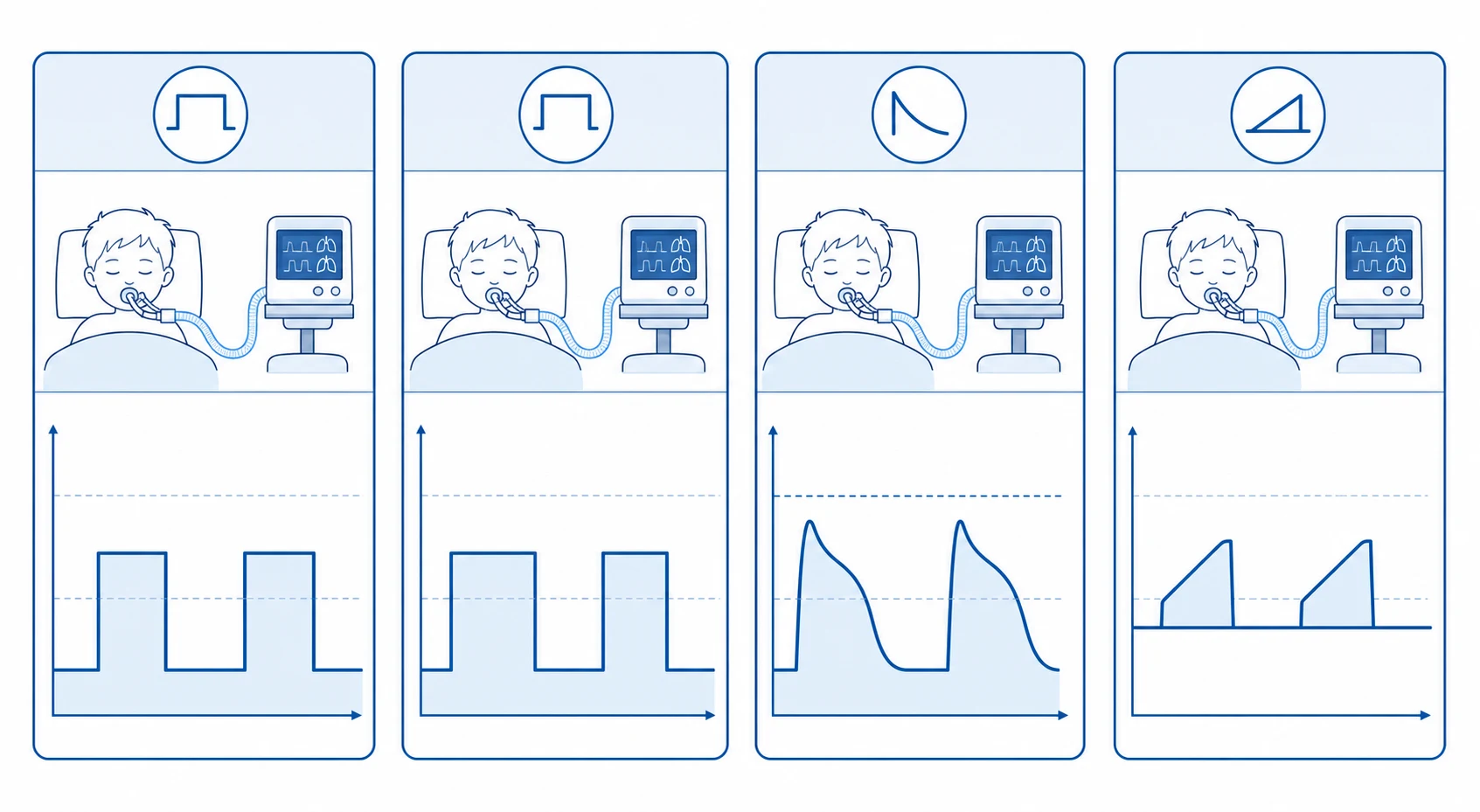 Four-panel schematic classifying paediatric ventilator modes by pressure-versus-time waveform. Volume control shows a square-wave pressure trace with constant delivered flow and a guaranteed tidal volume. Pressure control shows a rectangular pressure trace with a decelerating flow and variable volume. Pressure-regulated volume control shows a volume-targeted breath with breath-to-breath pressure adjustment to the lowest necessary pressure. Pressure support shows spontaneous patient-triggered breaths augmented by a ramping pressure above a baseline of positive end-expiratory pressure, used for weaning.