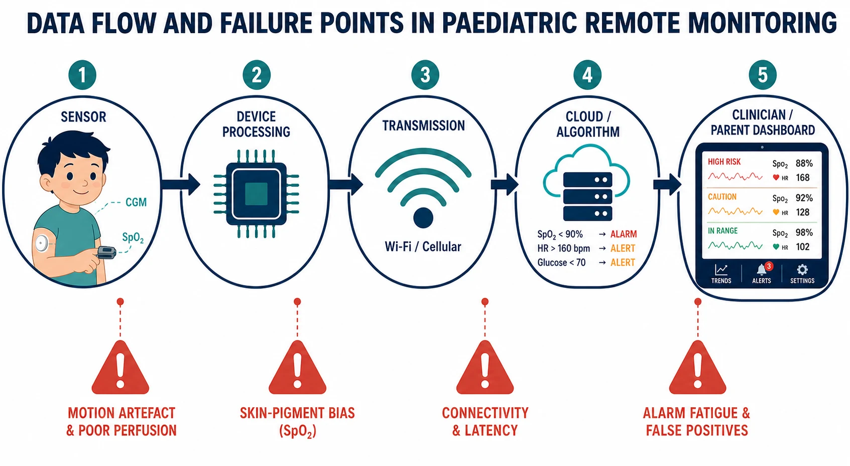 A schematic left-to-right data-flow pipeline of paediatric remote monitoring showing the five nodes — sensor (CGM patch and pulse oximeter on a child), device processing, transmission (Wi-Fi or cellular), cloud or algorithm with threshold rules, and clinician or parent dashboard with high-risk, caution and in-range zones — and four red warning icons flagging the failure points: motion artefact and poor perfusion at the sensor, skin-pigment bias of SpO2 at processing, connectivity and latency at transmission, and alarm fatigue and false positives at the dashboard