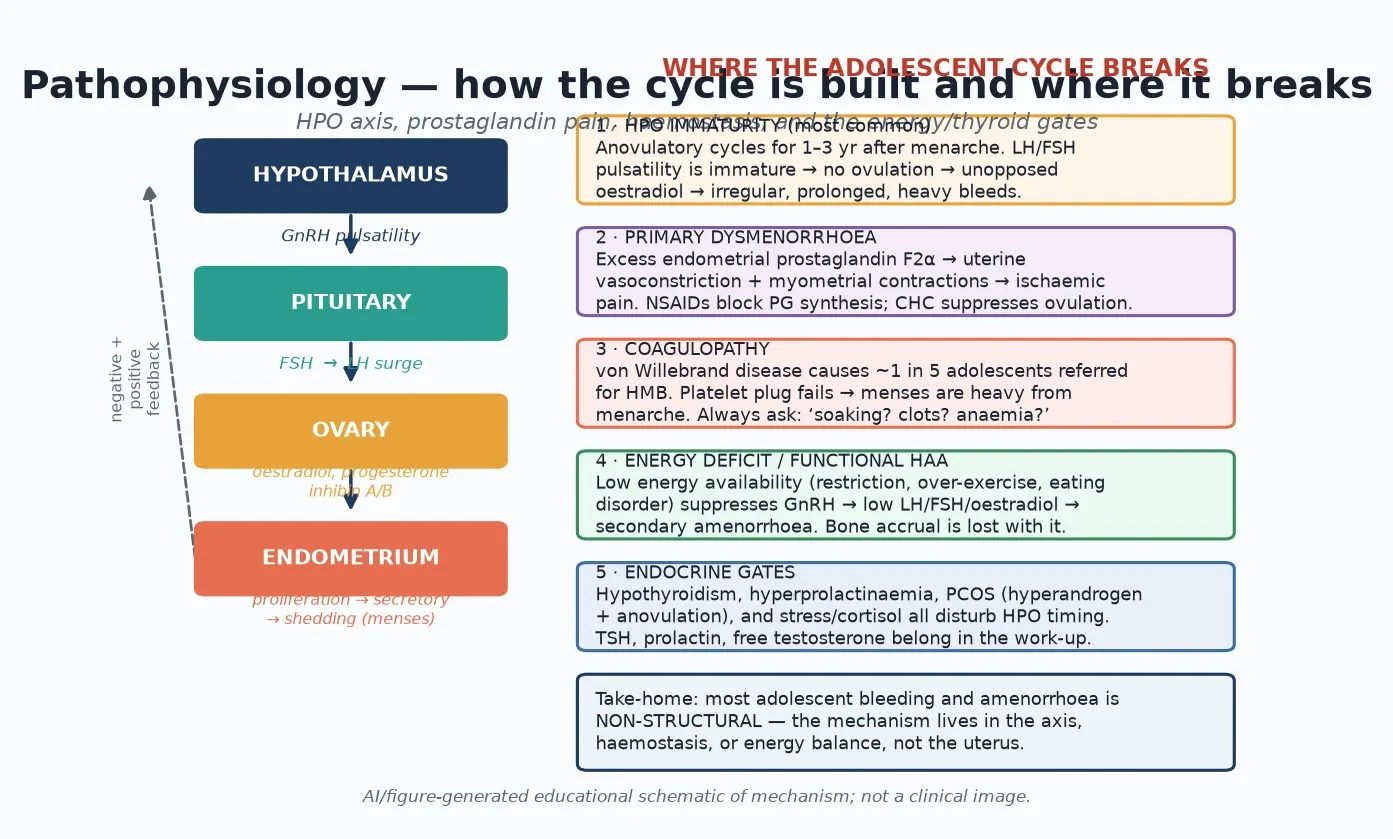 Educational schematic of the hypothalamic-pituitary-ovarian axis and the five common adolescent mechanisms of cycle disturbance: HPO immaturity, prostaglandin-mediated dysmenorrhoea, coagulopathy, energy deficit, and endocrine gates