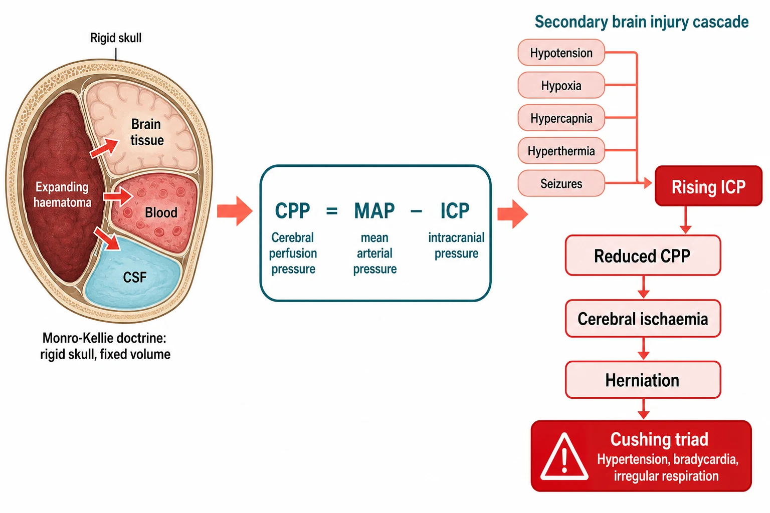 A clean scientific causal schematic on a white background showing the pathophysiology of rising intracranial pressure. A central box displays the equation that cerebral perfusion pressure equals mean arterial pressure minus intracranial pressure, abbreviated CPP equals MAP minus ICP. On the left a rigid skull holds brain tissue, blood, and CSF with an expanding dark haematoma pressing on the other compartments, captioned the Monro-Kellie doctrine. Coral arrows lead from secondary insults of hypotension, hypoxia, hypercapnia, hyperthermia, and seizures into a red box labelled rising ICP, then downward to reduced CPP, cerebral ischaemia, and herniation. A red warning box at the bottom labelled Cushing triad lists hypertension, bradycardia, and irregular respiration.