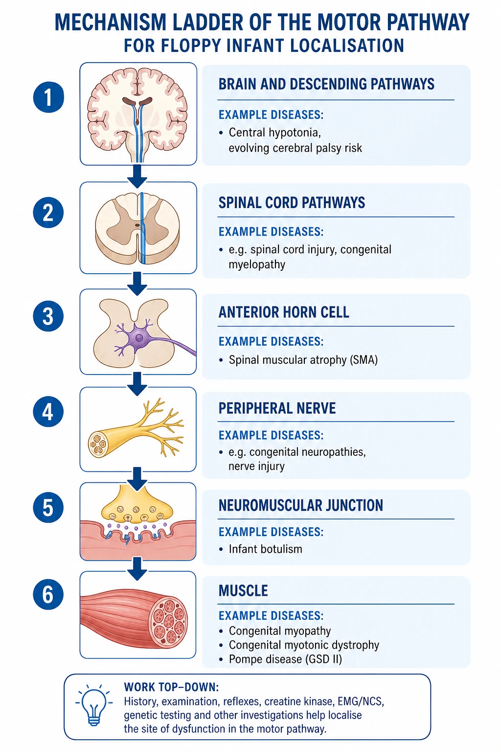 Educational ladder diagram of brain, spinal pathways, anterior horn cell, nerve, neuromuscular junction and muscle with example floppy-infant diseases at each level
