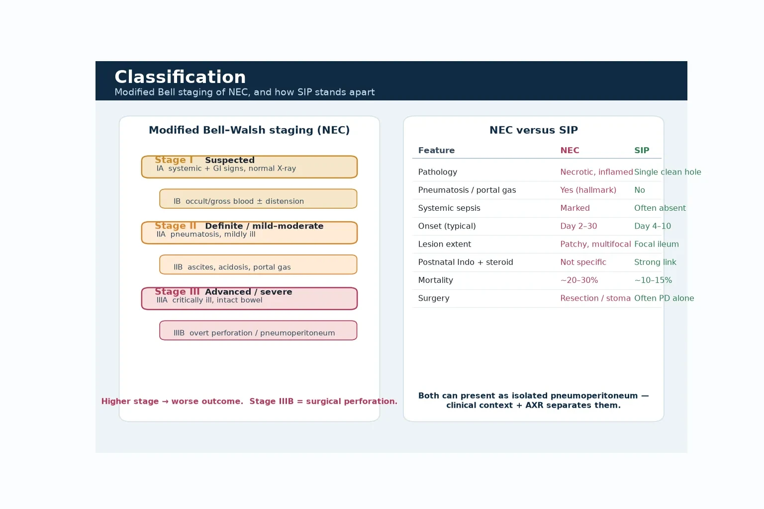 Educational figure with two panels: the modified Bell-Walsh staging ladder of NEC (Stage I suspected, Stage II definite with IIA and IIB, Stage III advanced with IIIA and IIIB) on the left, and a side-by-side NEC versus SIP comparison table on the right