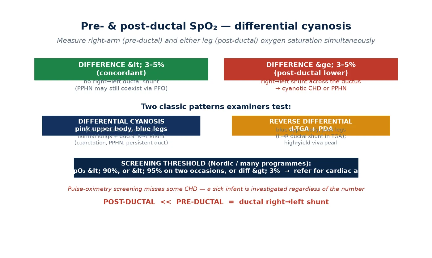 Pre- and post-ductal oxygen saturation measurement showing differential cyanosis and reverse differential cyanosis with the Nordic screening thresholds