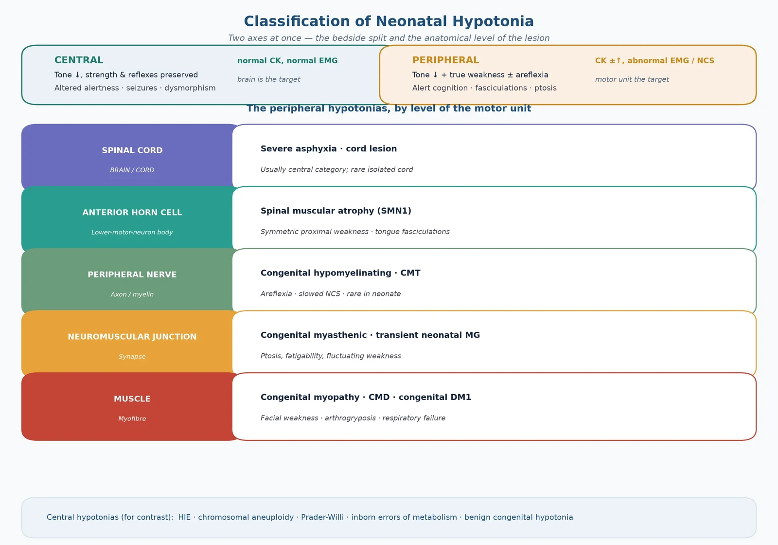 Classification of neonatal hypotonia by the bedside central-versus-peripheral split and by the anatomical level of the motor-unit lesion (spinal cord, anterior horn, nerve, neuromuscular junction, muscle) with example diagnoses