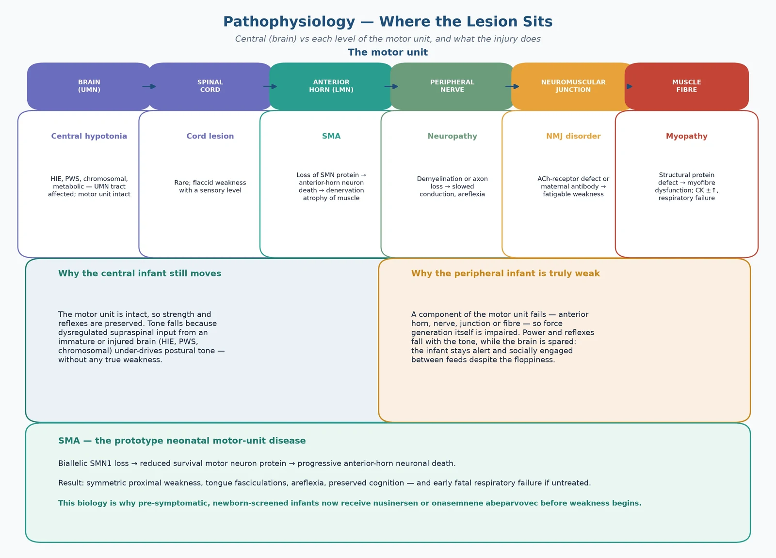 The motor unit from brain to muscle, showing where each disease sits — SMA at the anterior horn, neuropathy at the nerve, NMJ disorders at the junction, myopathies at the muscle — and why central hypotonia preserves strength while peripheral hypotonia does not