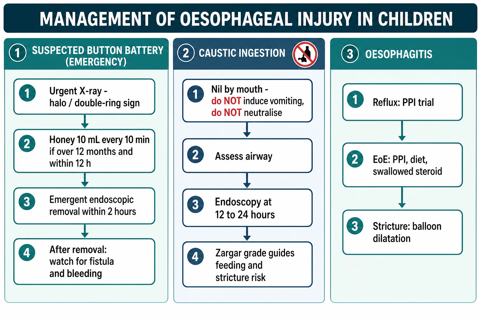 Management algorithm for paediatric oesophageal injury in three swimlanes: suspected button battery with urgent X-ray, honey pre-removal and emergent endoscopic removal within two hours then watch for fistula and bleeding; caustic ingestion with nil by mouth and no induced vomiting or neutralisation, airway assessment and endoscopy at 12 to 24 hours graded by Zargar; and oesophagitis with reflux PPI trial, eosinophilic PPI diet and swallowed steroid, and stricture balloon dilatation