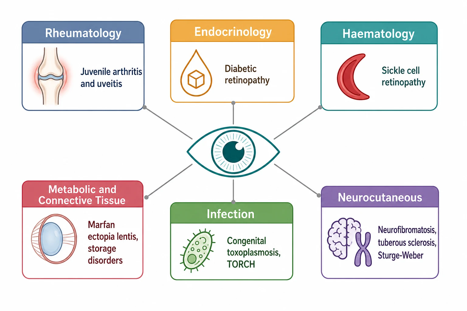 A clean schematic on a white background in landscape showing a central stylised child eye in teal line art, with six colour-coded category boxes arranged radially around it. The boxes label the six systemic categories with small icons: a slate-blue rheumatology box with an inflamed joint, a soft-amber endocrinology box with a glucose droplet, a teal haematology box with a crescent red cell, a purple neurocutaneous box with a brain and chromosome, a green infection box with a microbe, and a rose-red metabolic and connective tissue box with a lens and ring. Thin grey lines connect each box to the eye.
