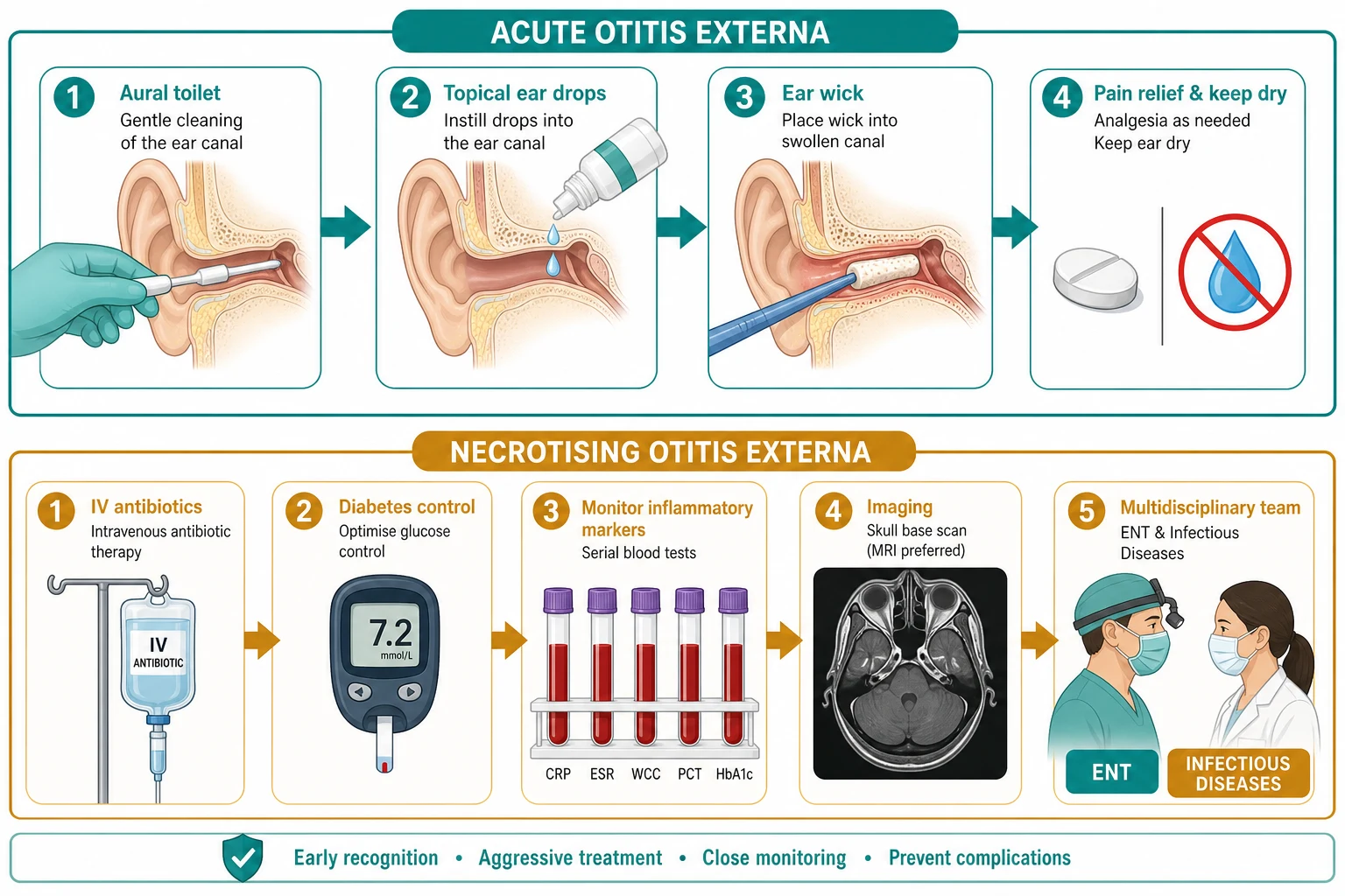 Two-row stepwise management pathway: the top row for acute otitis externa flows through analgesia, aural toilet, topical ear drops, an expandable ear wick for a swollen canal, and keeping the ear dry; the bottom row for necrotising otitis externa shows hospital care with an intravenous antipseudomonal line, a glucose meter for diabetes control, serial inflammatory-marker blood tests, and a skull-base scan with an ENT and infectious-diseases team.