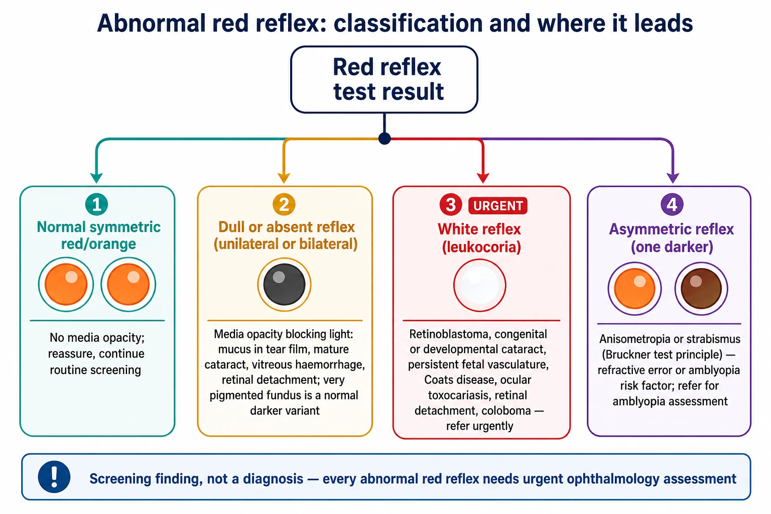 Schematic four-branch flowchart from a central red-reflex test result node: a teal branch to normal symmetric red or orange with reassurance and continued screening; an amber branch to a dull or absent reflex from a media opacity (mucus, cataract, vitreous haemorrhage, retinal detachment) or a normally dark pigmented fundus; a red urgent branch to a white reflex or leukocoria listing retinoblastoma, congenital or developmental cataract, persistent fetal vasculature, Coats disease, ocular toxocariasis, retinal detachment and coloboma; and a purple branch to an asymmetric reflex from anisometropia or strabismus (the Bruckner principle) needing amblyopia assessment