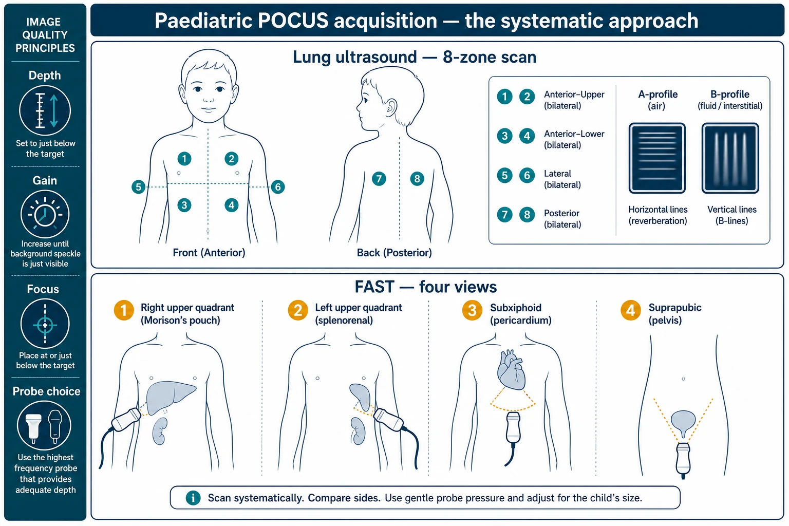 Educational schematic of the systematic paediatric POCUS acquisition — the eight-zone bilateral lung scan with numbered scanning points on front and side chest views, the four FAST windows marked on a child torso, and a side ribbon of image-quality principles (depth, gain, focus, probe choice)