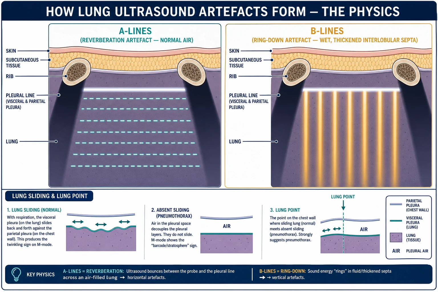 Educational cross-section schematic explaining lung ultrasound artefacts — A-lines as horizontal reverberation lines below the pleural line in a dry air-filled lung, B-lines as vertical comet-tail streaks from the pleural line in a wet lung, the pleural line between two rib shadows, and an inset showing lung sliding versus absent sliding with a lung point marked by an arrow