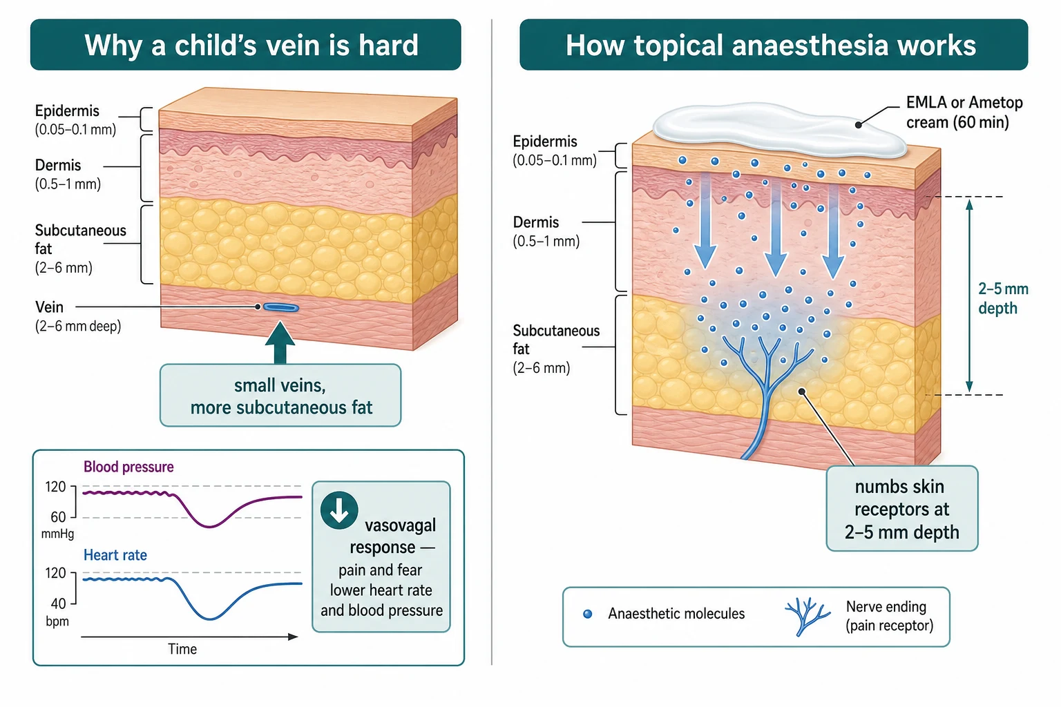 Two columns: the left shows a skin cross-section with a small vein under subcutaneous fat and a falling blood pressure and heart rate trace labelled vasovagal response; the right shows topical anaesthetic cream diffusing through the epidermis and dermis to nerve endings