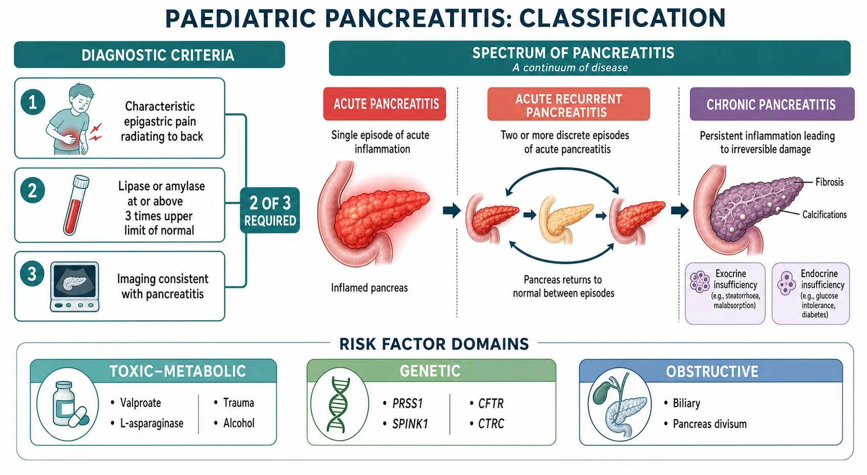 Classification of paediatric pancreatitis as a temporal spectrum: Acute pancreatitis defined by the NASPGHAN two-of-three criteria of characteristic epigastric pain, lipase or amylase at or above three times the upper limit of normal, and imaging consistent with pancreatitis; Acute recurrent pancreatitis defined as two or more discrete episodes with complete recovery between them; Chronic pancreatitis defined by irreversible morphological change on imaging with endocrine or exocrine insufficiency. Below the spectrum, three risk-factor domains: Toxic-metabolic including valproate, L-asparaginase, alcohol and trauma; Genetic including PRSS1, SPINK1, CFTR and CTRC; Obstructive including biliary microlithiasis, pancreas divisum and ductal anomalies.