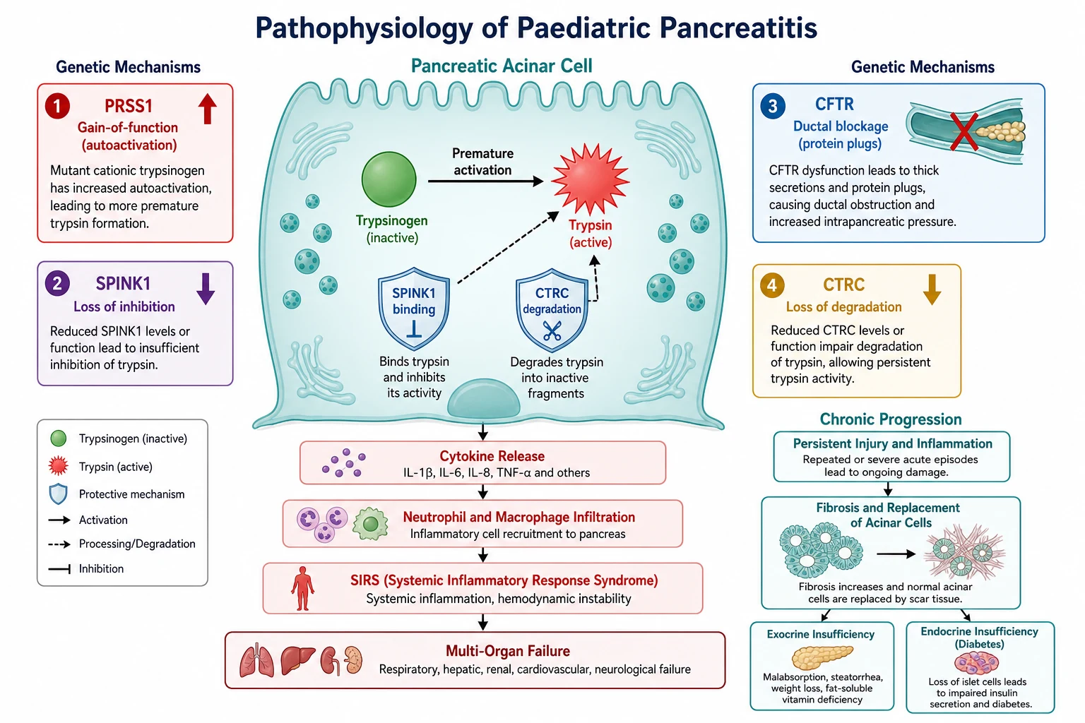 Pathophysiology of paediatric pancreatitis showing the acinar cell as the centre of injury: trypsinogen prematurely activated to trypsin inside the cell; the protective mechanisms of SPINK1 (serine protease inhibitor Kazal type 1) binding and inhibiting trypsin, and CTRC (chymotrypsin C) degrading active trypsin; the four genetic mechanisms that disturb the balance — PRSS1 gain-of-function increasing autoactivation, SPINK1 loss reducing inhibition, CFTR loss impairing ductal flush allowing protein plugs, and CTRC loss reducing degradation; the downstream inflammatory cascade from acinar injury through cytokine release and neutrophil and macrophage infiltration to systemic inflammatory response syndrome and multi-organ failure; and the progression to chronic disease with fibrosis, ductal distortion and acinar loss leading to exocrine and endocrine insufficiency.
