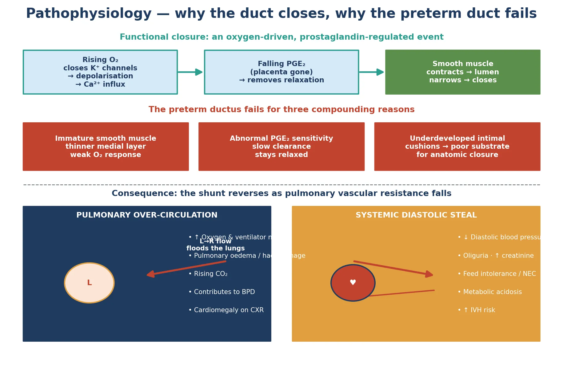 Educational schematic of fetal ductal shunting, then postnatal oxygen-driven smooth muscle contraction, contrasted with the immature preterm ductus failing to close; the right panel shows the falling pulmonary vascular resistance converting the shunt to left-to-right flow with pulmonary over-circulation and systemic diastolic steal