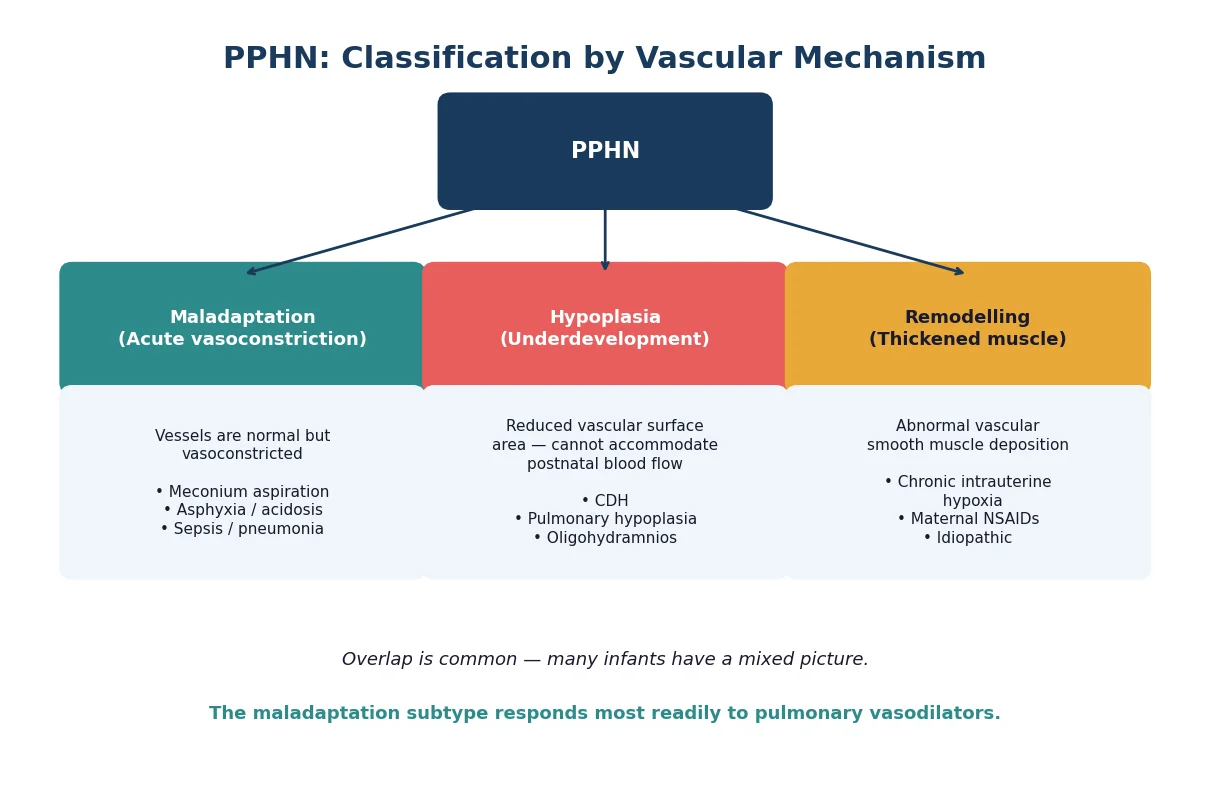 Classification chart showing the three PPHN mechanisms: maladaptation, hypoplasia, and remodelling with associated conditions