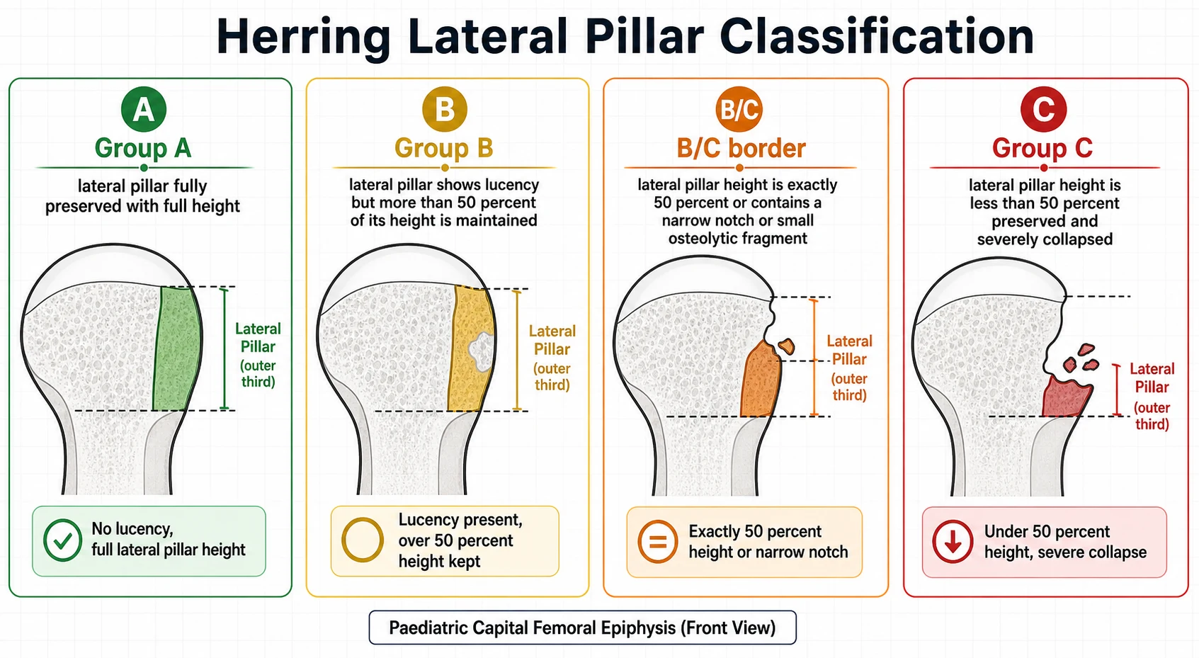 Four-panel infographic titled Herring Lateral Pillar Classification. Panel A green labelled Group A shows a femoral head with the lateral pillar fully preserved at full height with no lucency. Panel B amber labelled Group B shows the lateral pillar with lucency but more than 50 per cent height maintained. Panel B/C border orange shows the lateral pillar at exactly 50 per cent height with a narrow notch. Panel C red labelled Group C shows the lateral pillar collapsed to less than 50 per cent of its height. Each panel shades the outer lateral third of the rounded femoral head.
