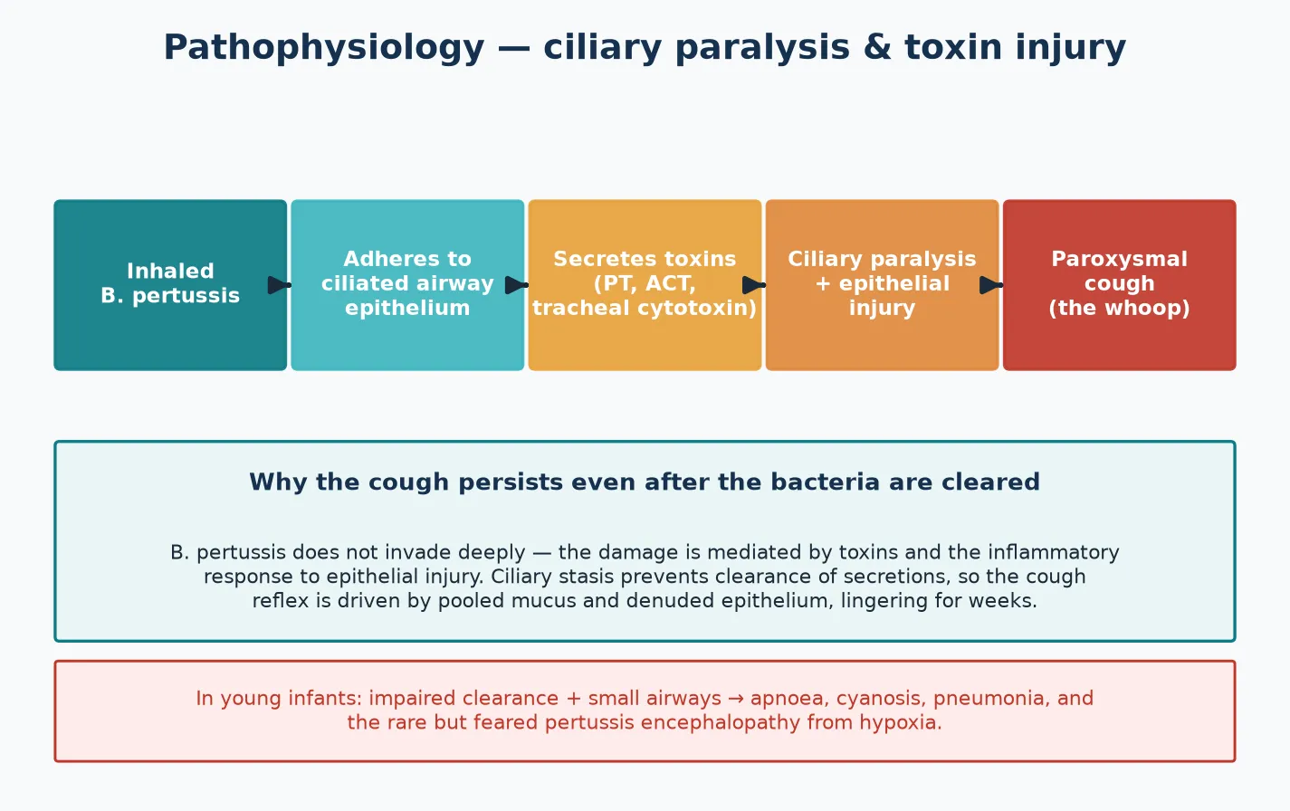 Left-to-right pathophysiology cascade: inhaled Bordetella pertussis adheres to ciliated airway epithelium, secretes toxins that paralyse cilia and injure epithelium, pooled secretions accumulate, and the irritant paroxysmal cough is generated; with an infant-severity footer explaining apnoea and pneumonia
